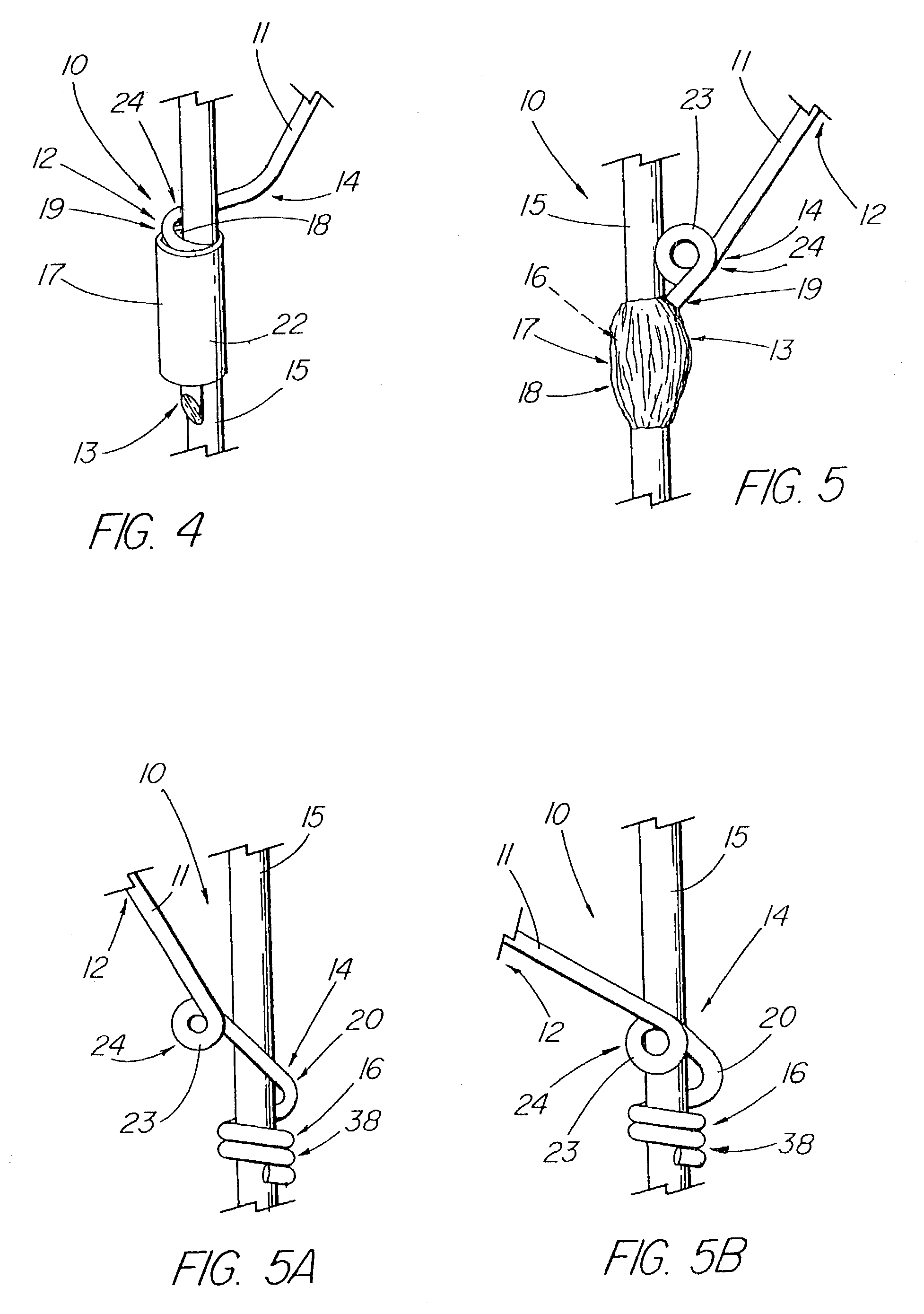 Flexible barb for anchoring a prosthesis