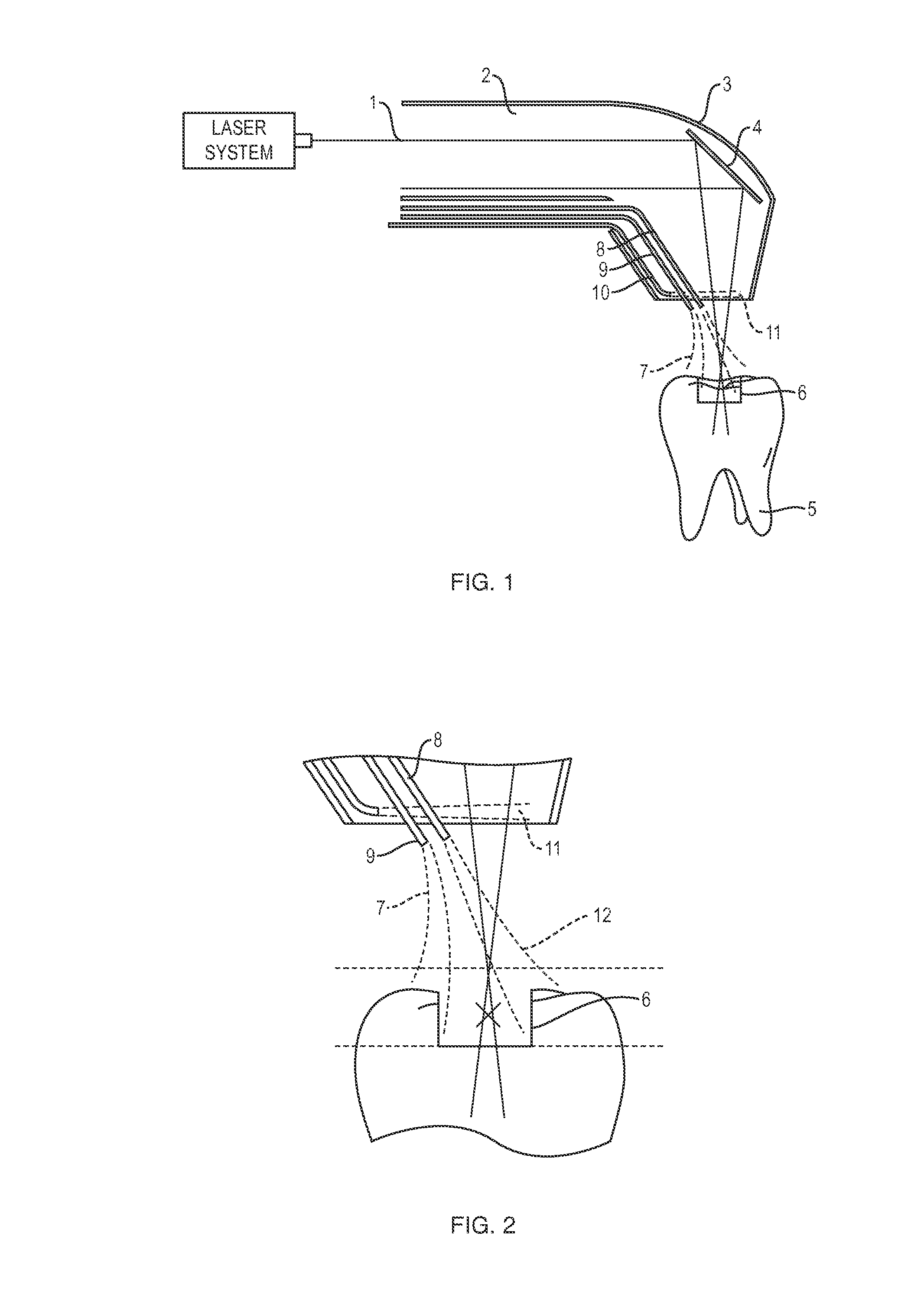 Apparatus and method for controlled fluid cooling during laser based dental treatments
