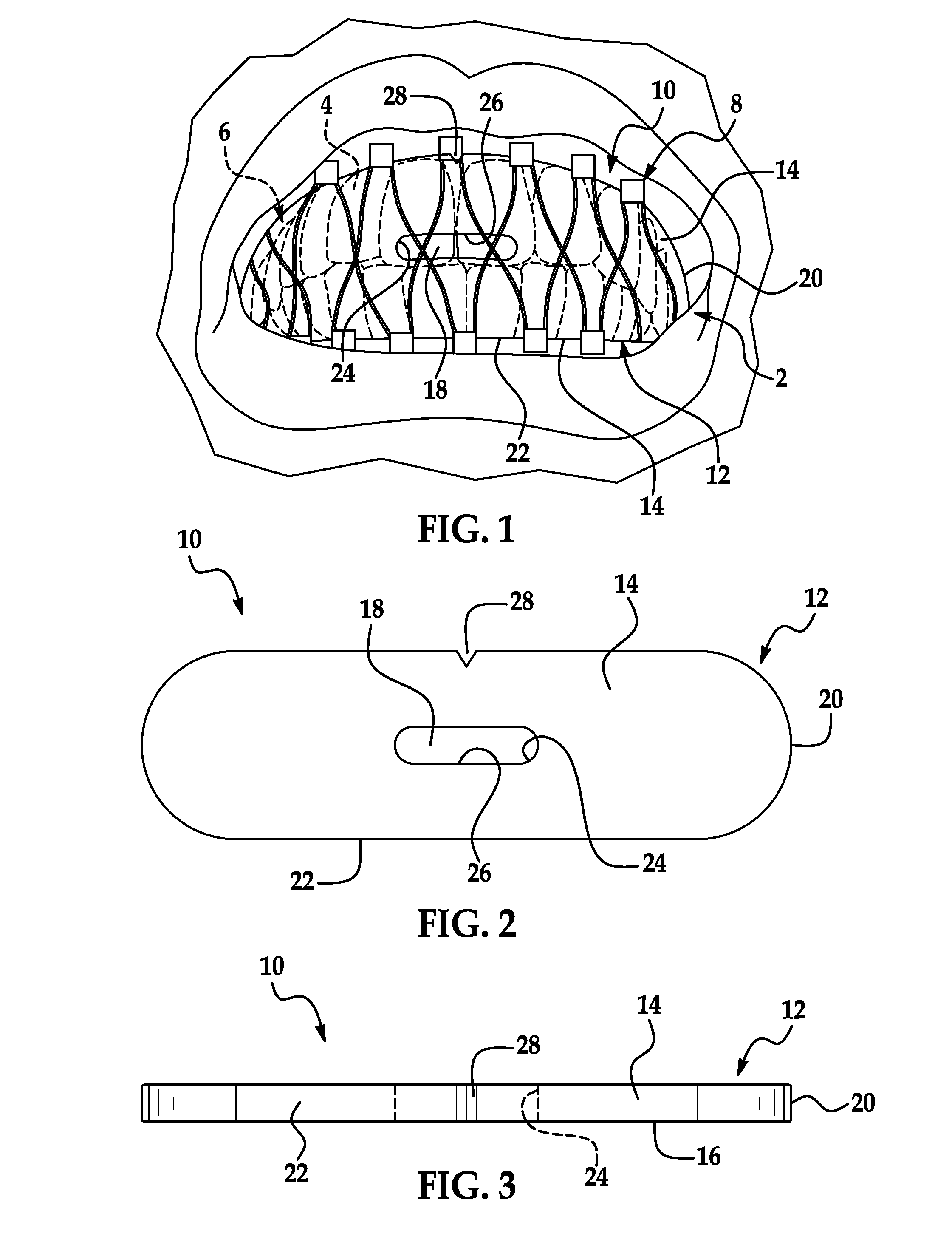 Wired-mouth-protection medical device