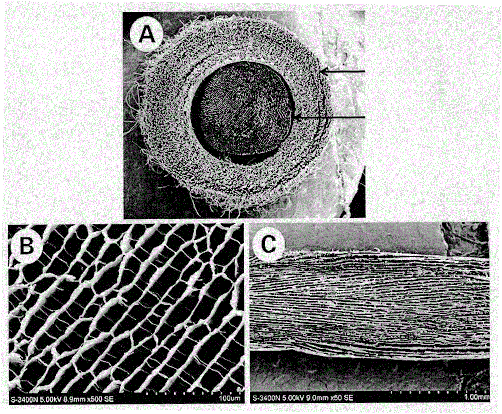 Preparation method and application of easy-to-suture array microtubular nerve regeneration stent