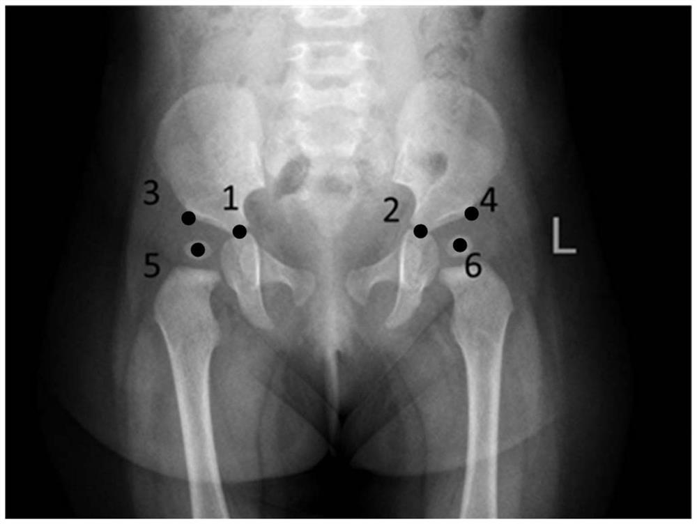 Key point extraction and bone age prediction method in hip joint imaging