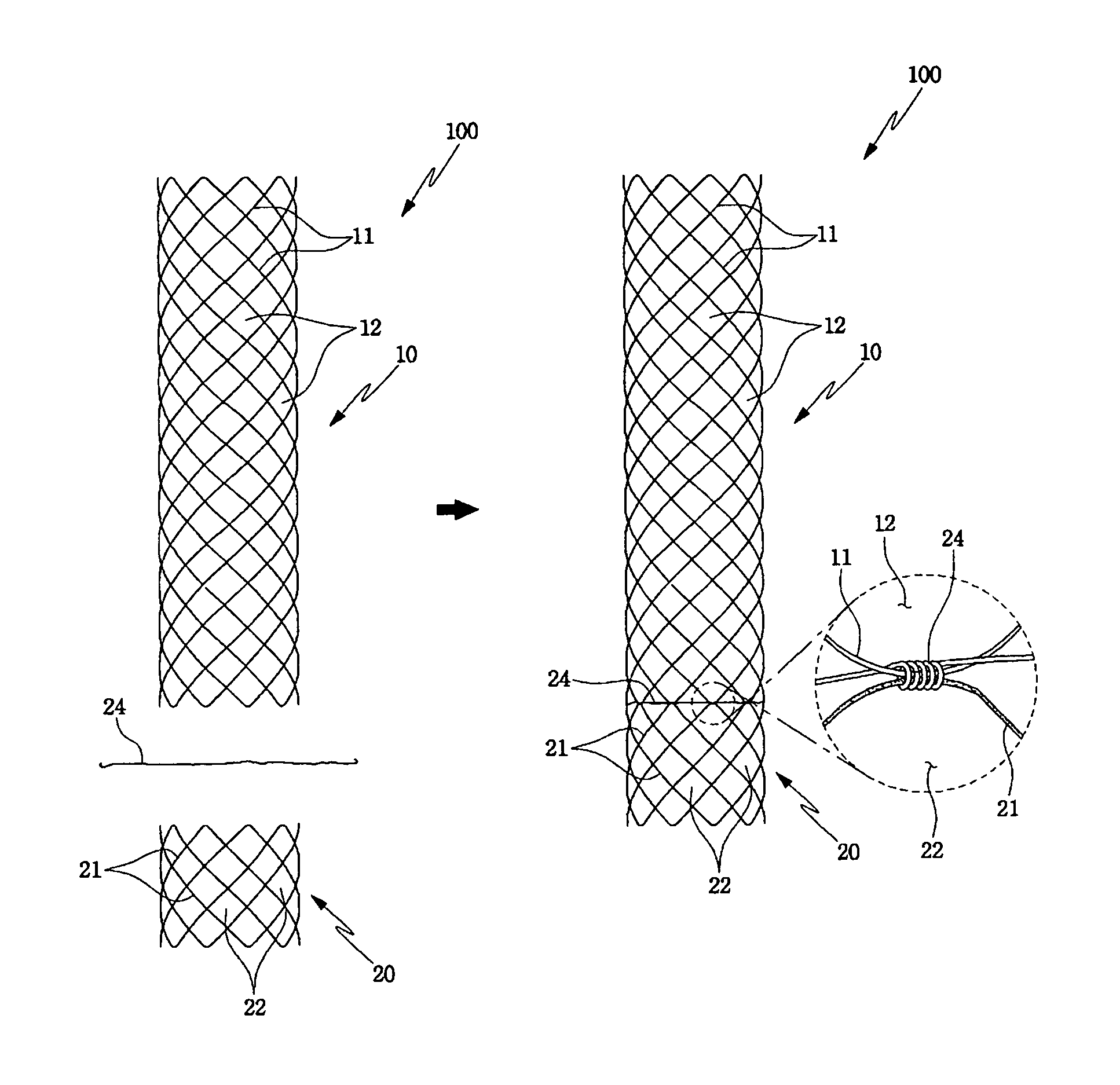 Partially biodegradable stent