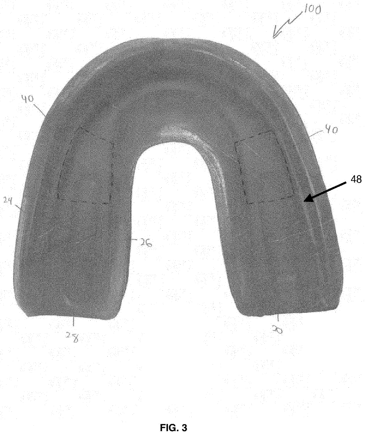 Mouthguard assembly