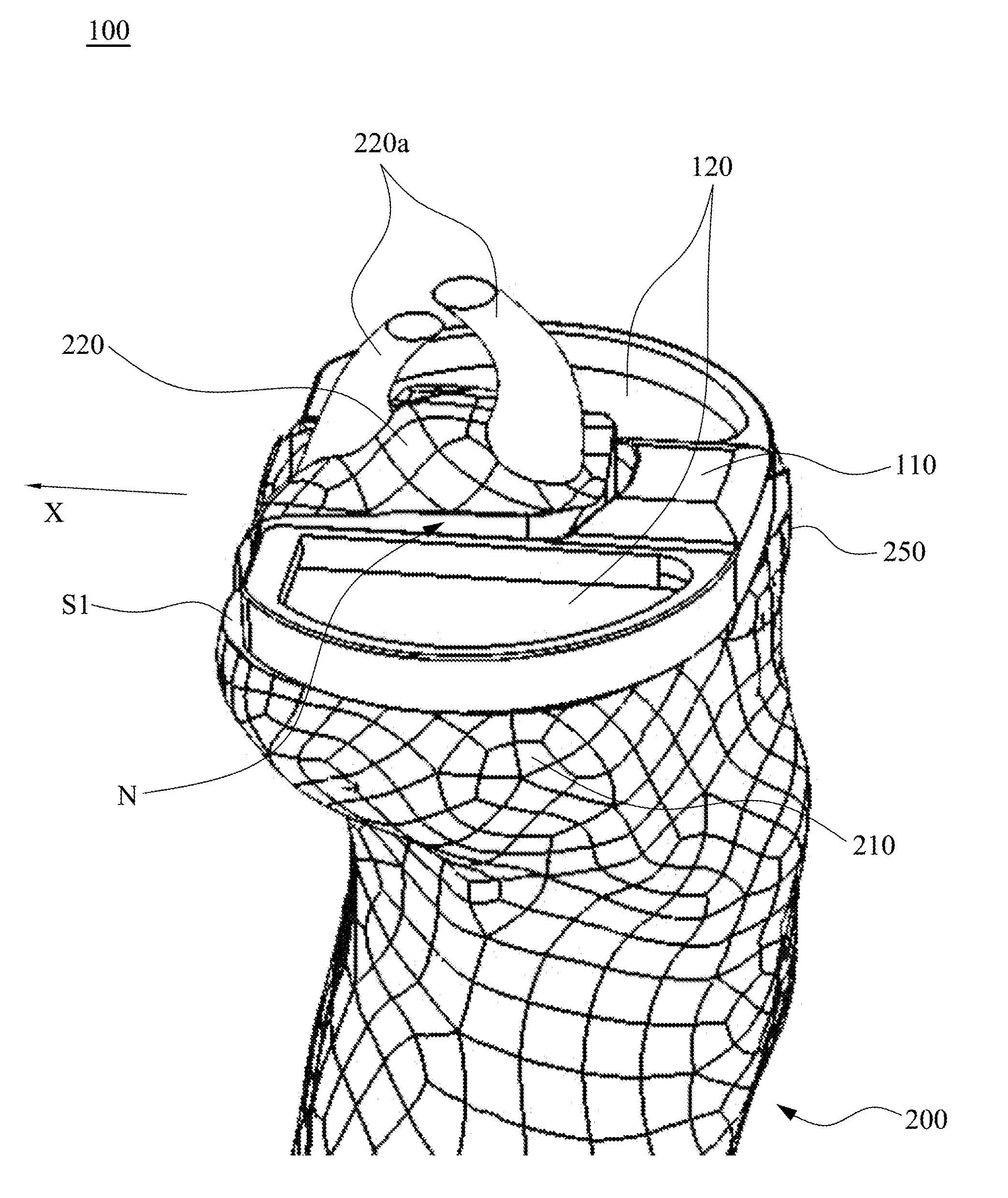 Tibial base plate and method for attaching a tibial base plate on a tibia