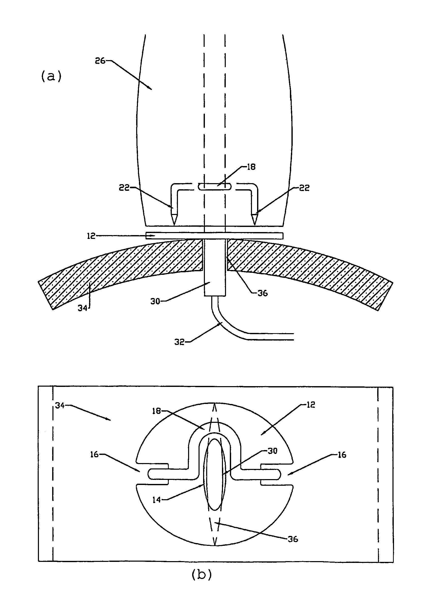 Surgical stapling device and method