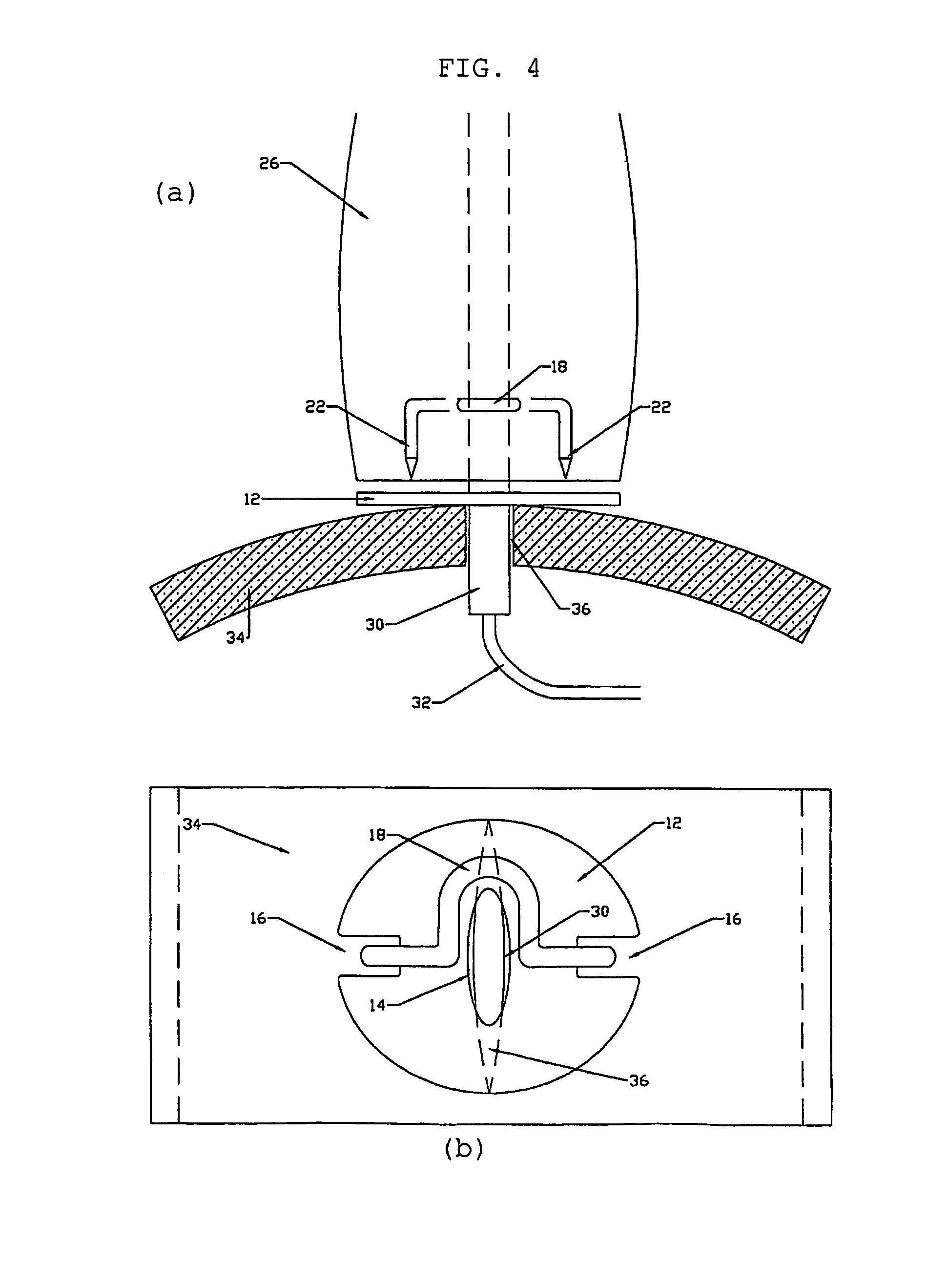 Surgical stapling device and method