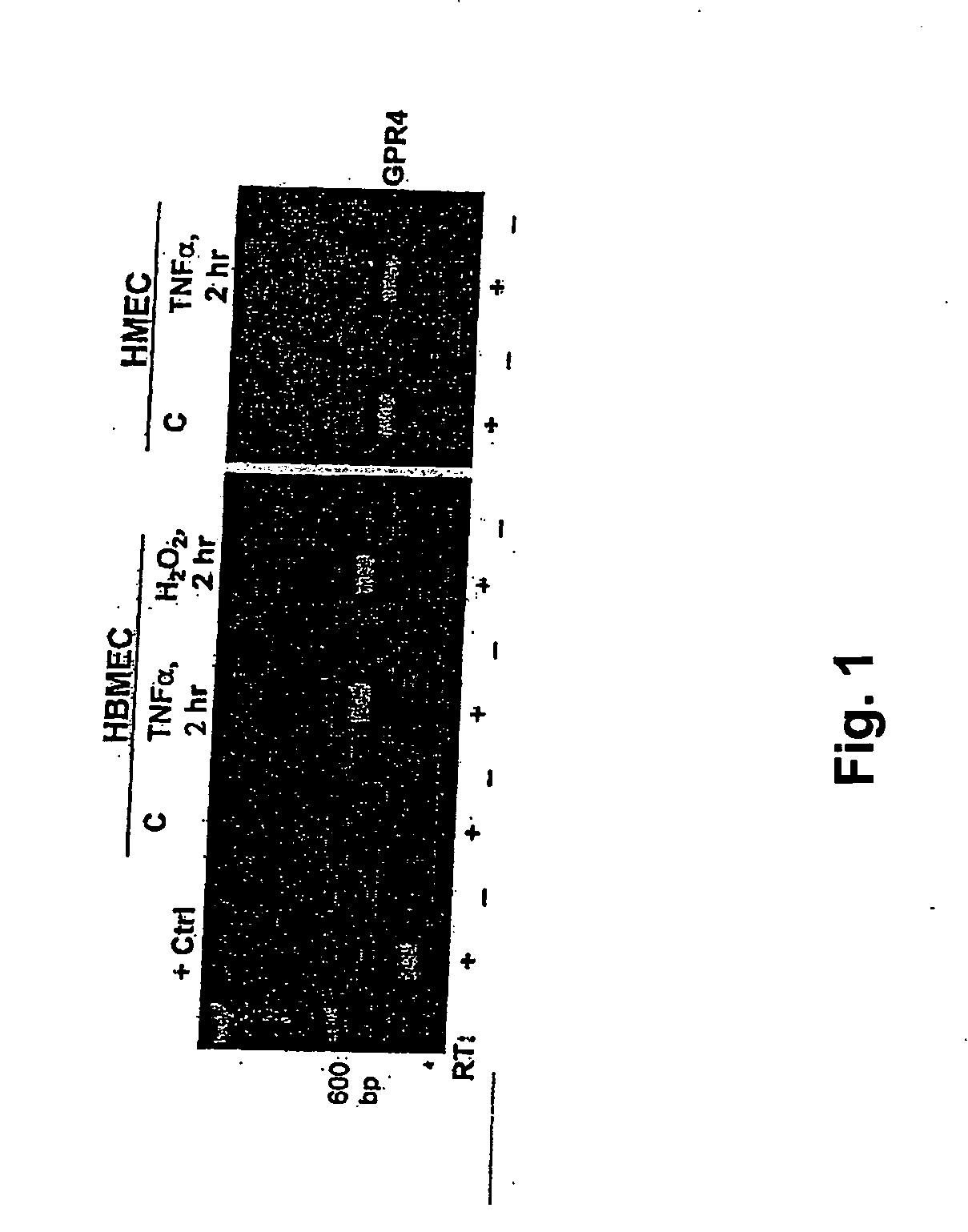 Receptor for lysophosphatidylcholine in vascular endothelial cells and use thereof