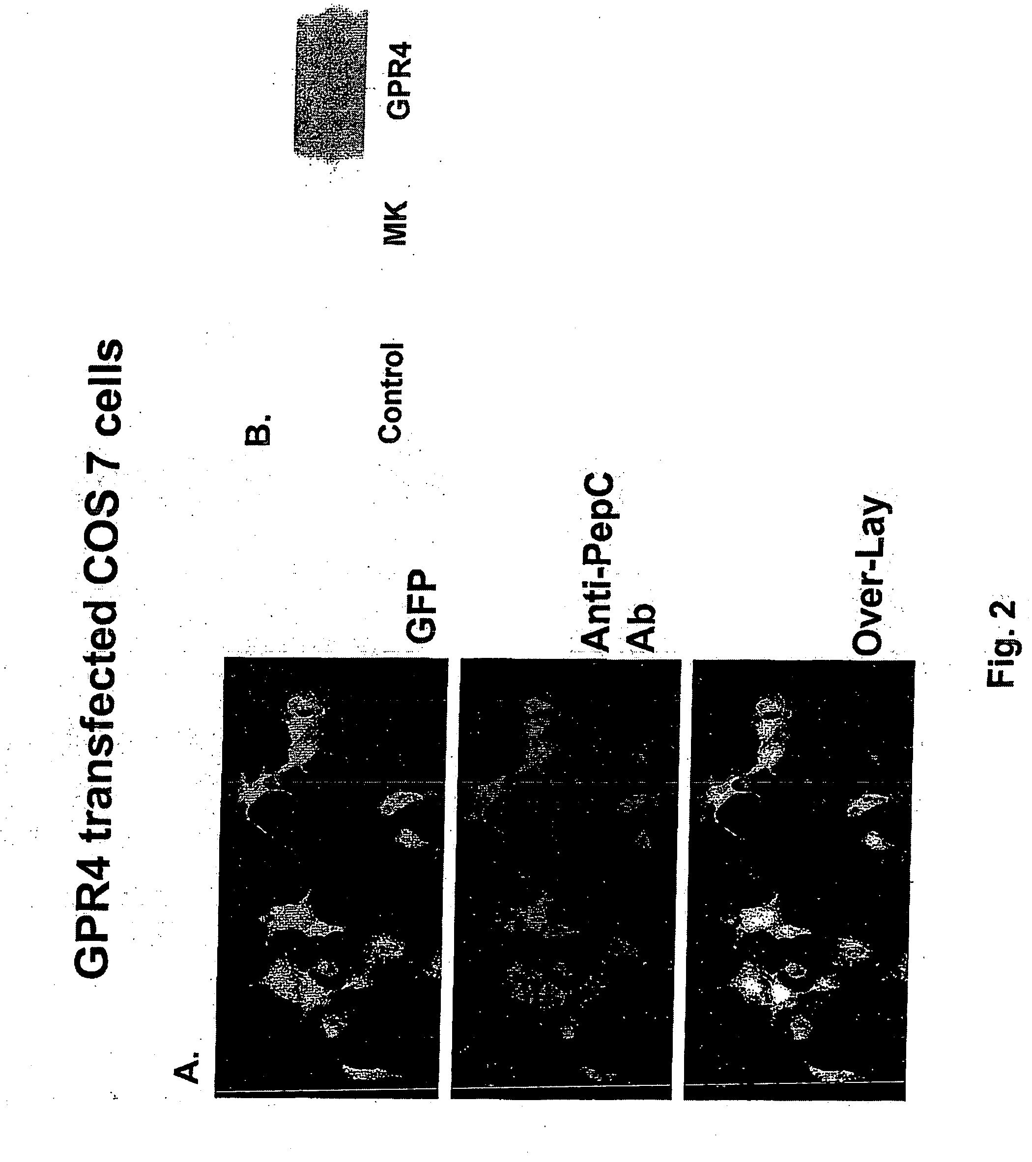 Receptor for lysophosphatidylcholine in vascular endothelial cells and use thereof