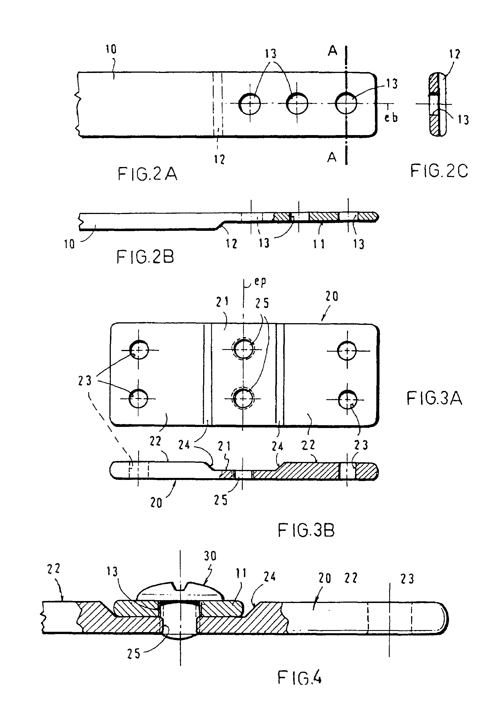 Apparatus for the correction of chest wall deformities such as Pectus Carinatum and method of using the same