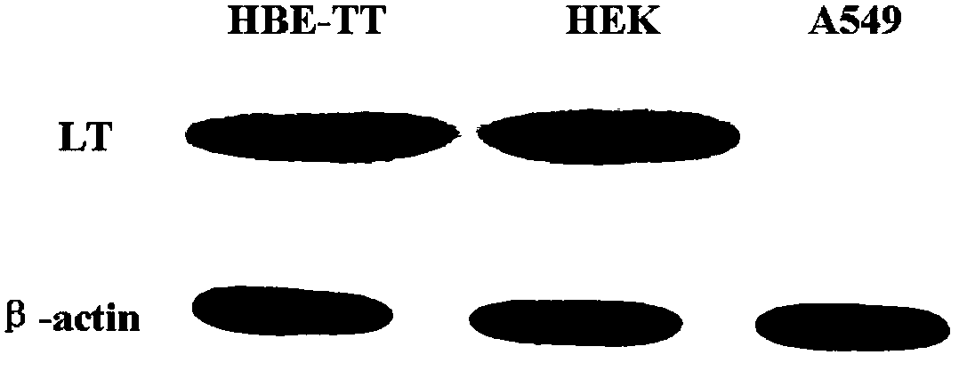 A human bronchial epithelial cell line hbe-tt