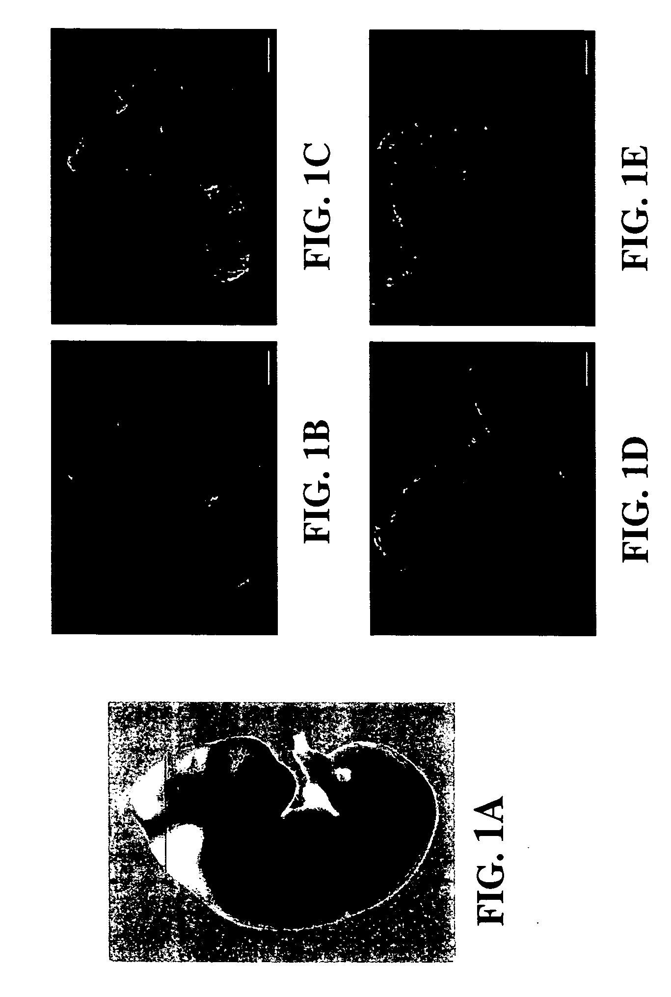 Reduction of embryonic neural tube defects by pre-or early-administration of germination-activated sporoderm-broken ganoderma lucidum spores to pregnant female