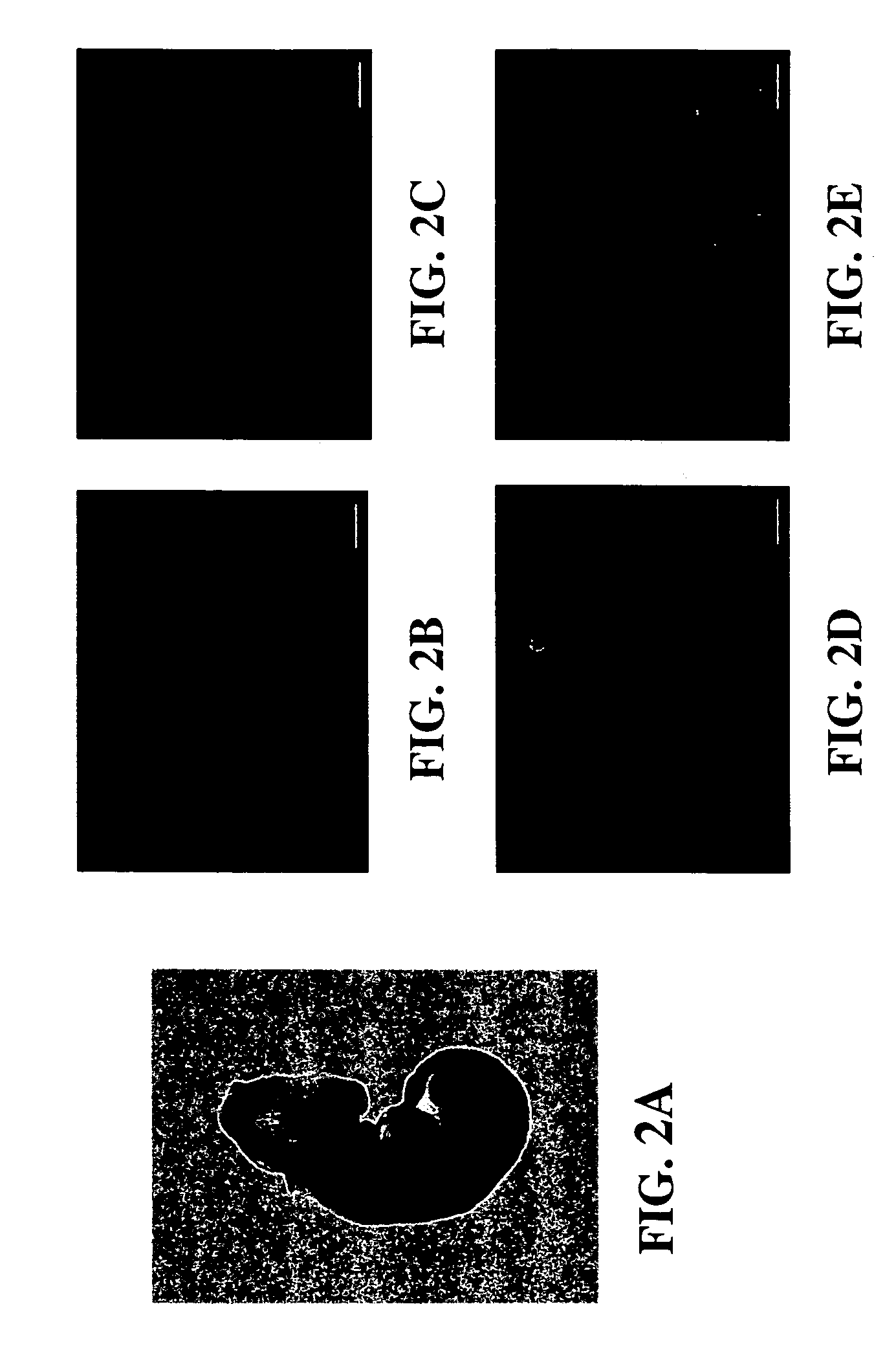 Reduction of embryonic neural tube defects by pre-or early-administration of germination-activated sporoderm-broken ganoderma lucidum spores to pregnant female