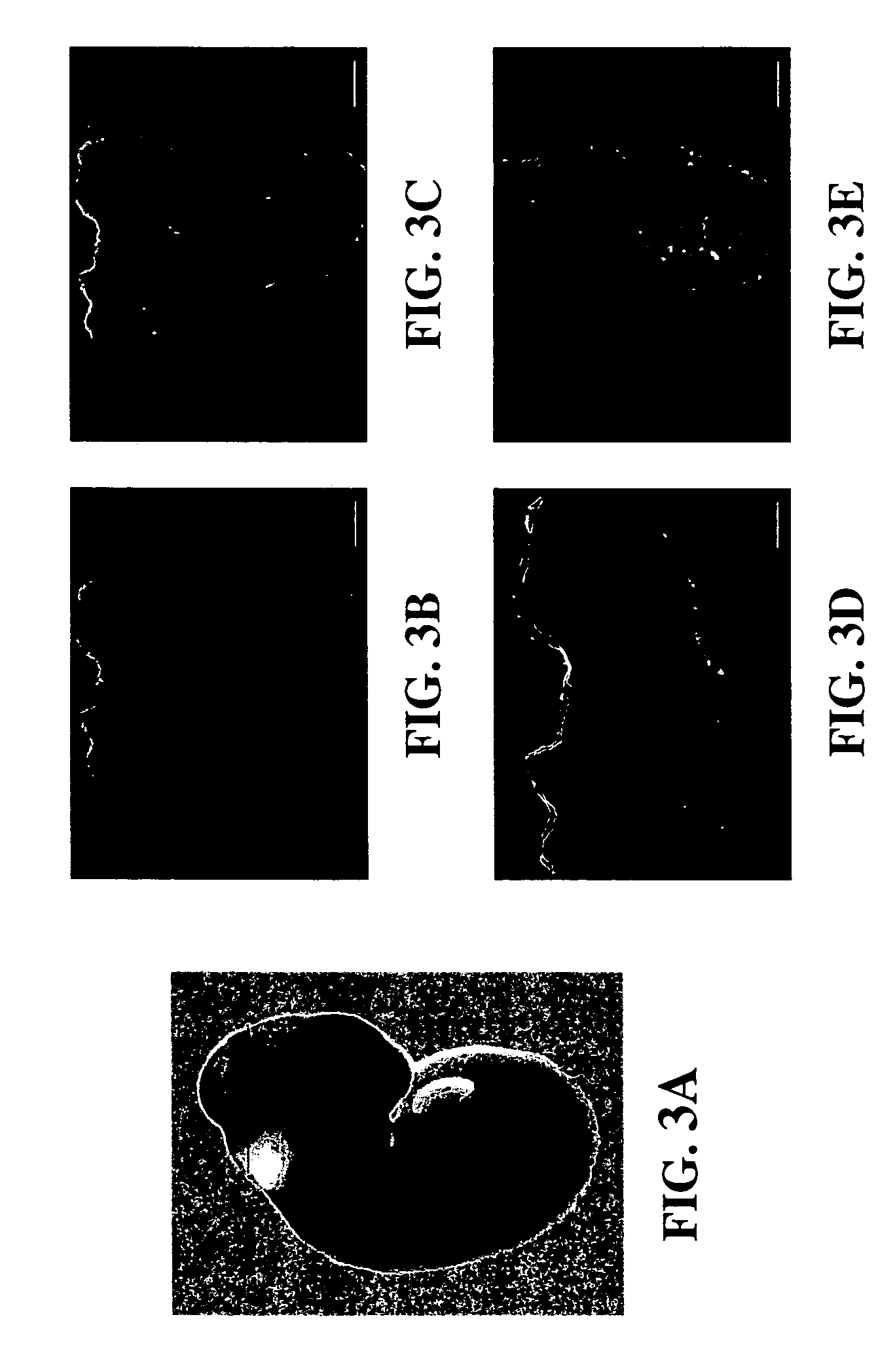 Reduction of embryonic neural tube defects by pre-or early-administration of germination-activated sporoderm-broken ganoderma lucidum spores to pregnant female