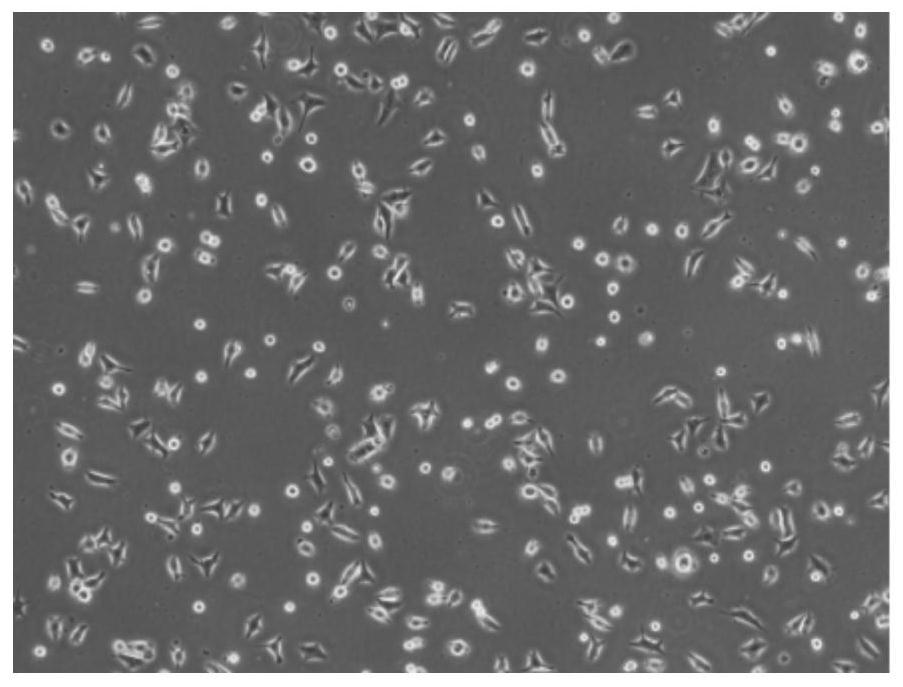 Method for obtaining artificial skin through stem cell in-vitro differentiation and application of method