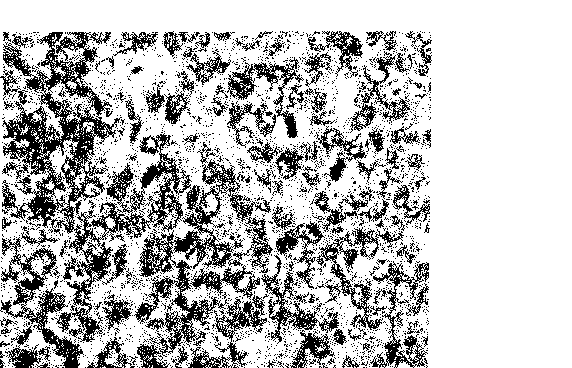 Terminal amido group start-type poly (lactic-co-glycolic acid)/polyglycol block copolymer, preparation method, medicament-carried nano micelle and application