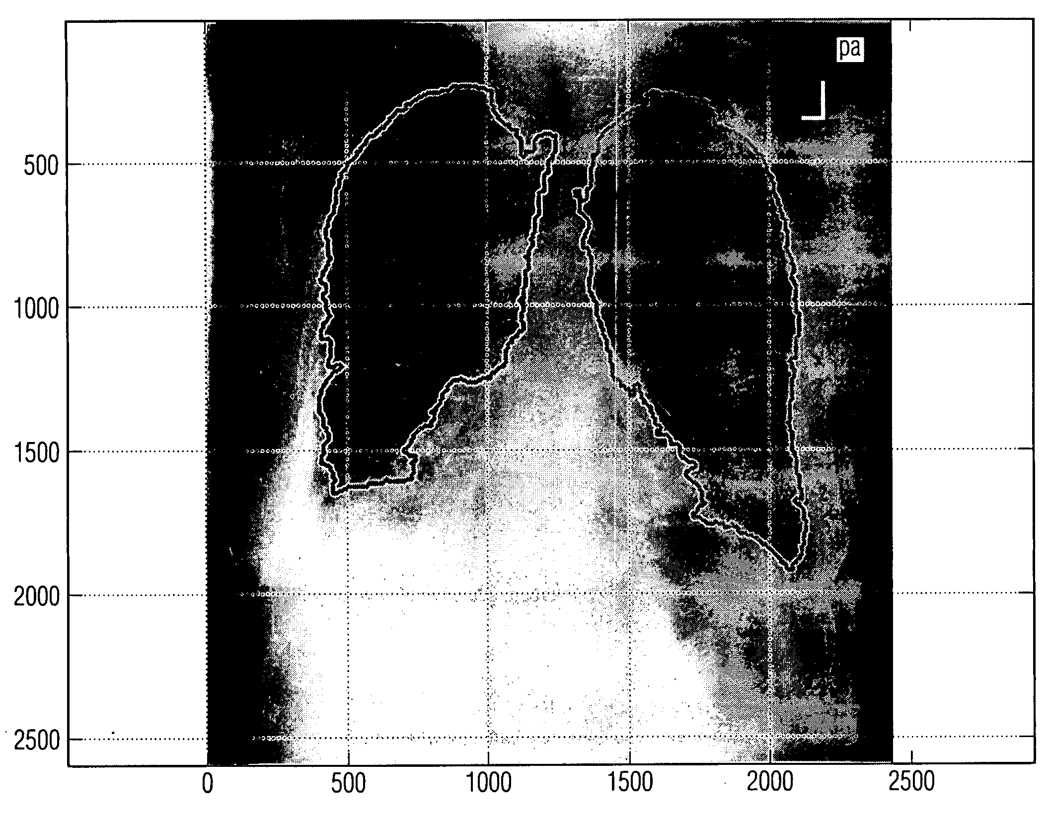 Method of suppressing obscuring features in an image