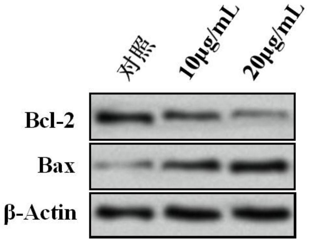 Enzymolysis polypeptide and application thereof in preparation of anti-leukemia drug