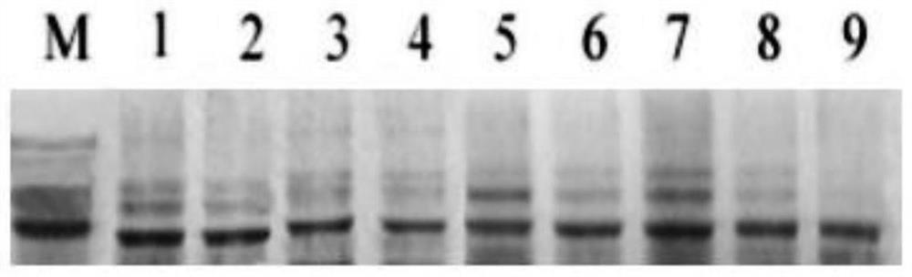 Recombinant antigen protein rP44-60 for detecting granulocytoplasmosis and kit containing antigen