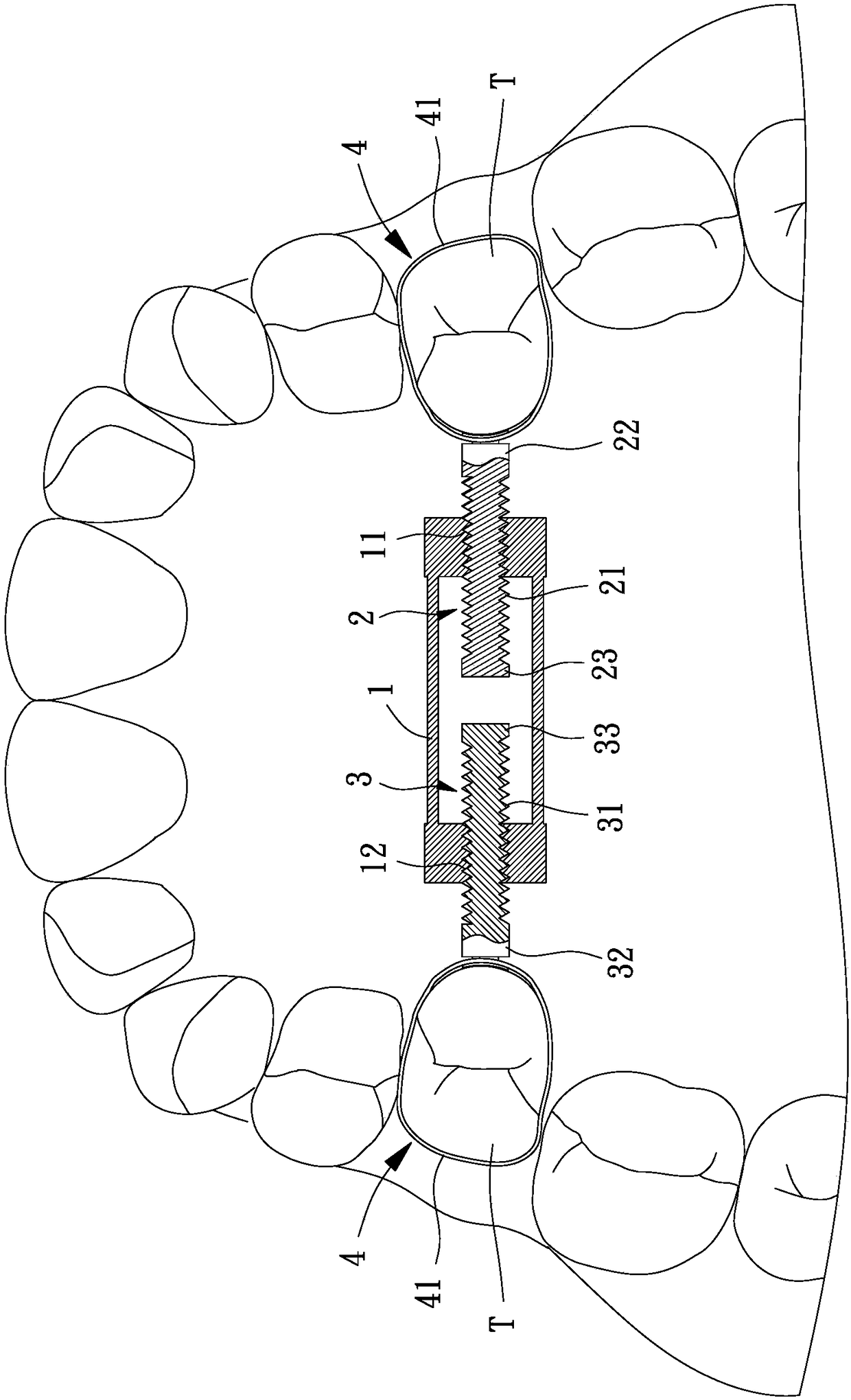 Tooth jaw maintaining device