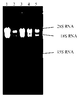 Enzyme for synthesizing cetyl-coenzyme A through cordyceps sinensis, gene and application thereof