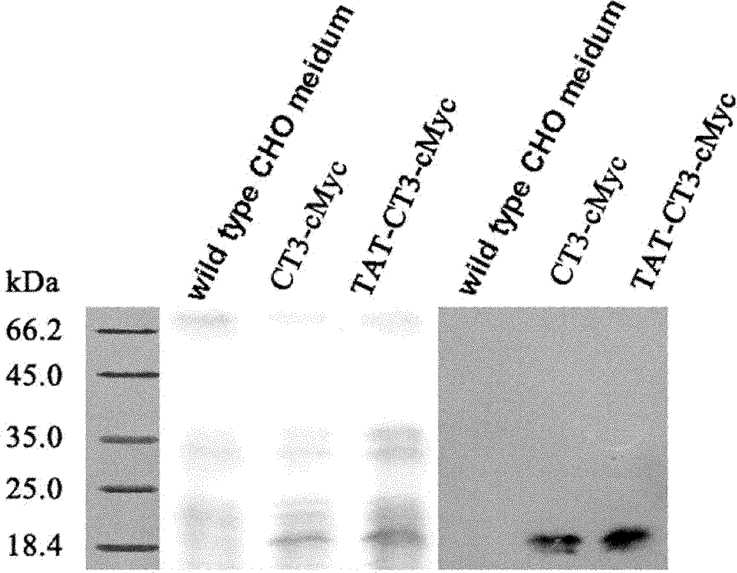 Eukaryon expression vector and application thereof to preparing medicament for inhibiting leukemia cell proliferation