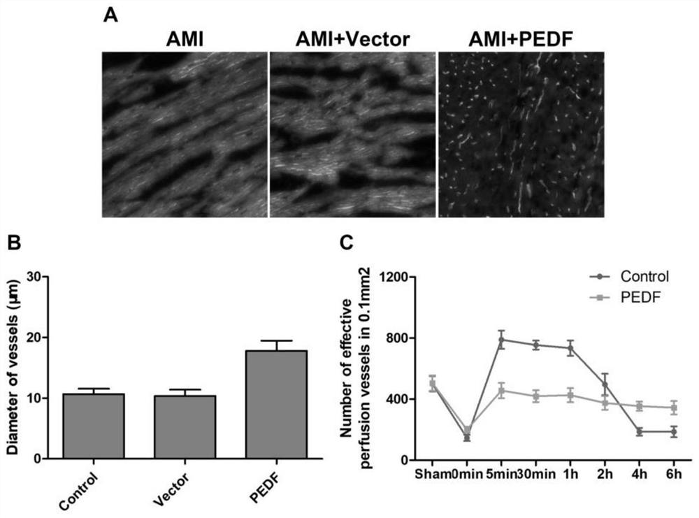 Application of pedf and its derivatives in the preparation of drugs for reconstructing coronary reserve collateral microcirculation and its drug screening method