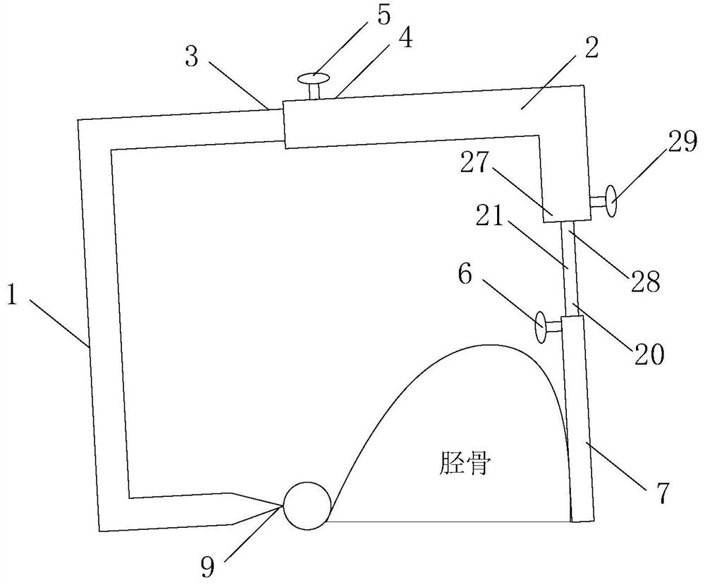 Osteotomy double-guide-plate system for high tibial osteotomy