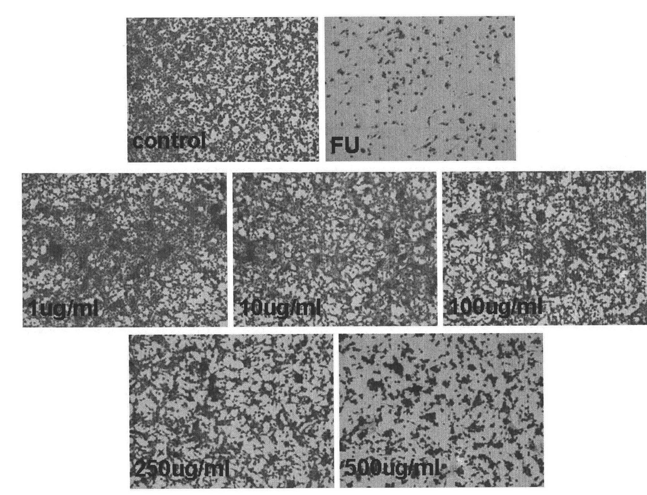 Application of erigeron breviscapus extract in preparing anti-tumor or angiogenesis-suppressing medicaments, health-care food or cosmetics