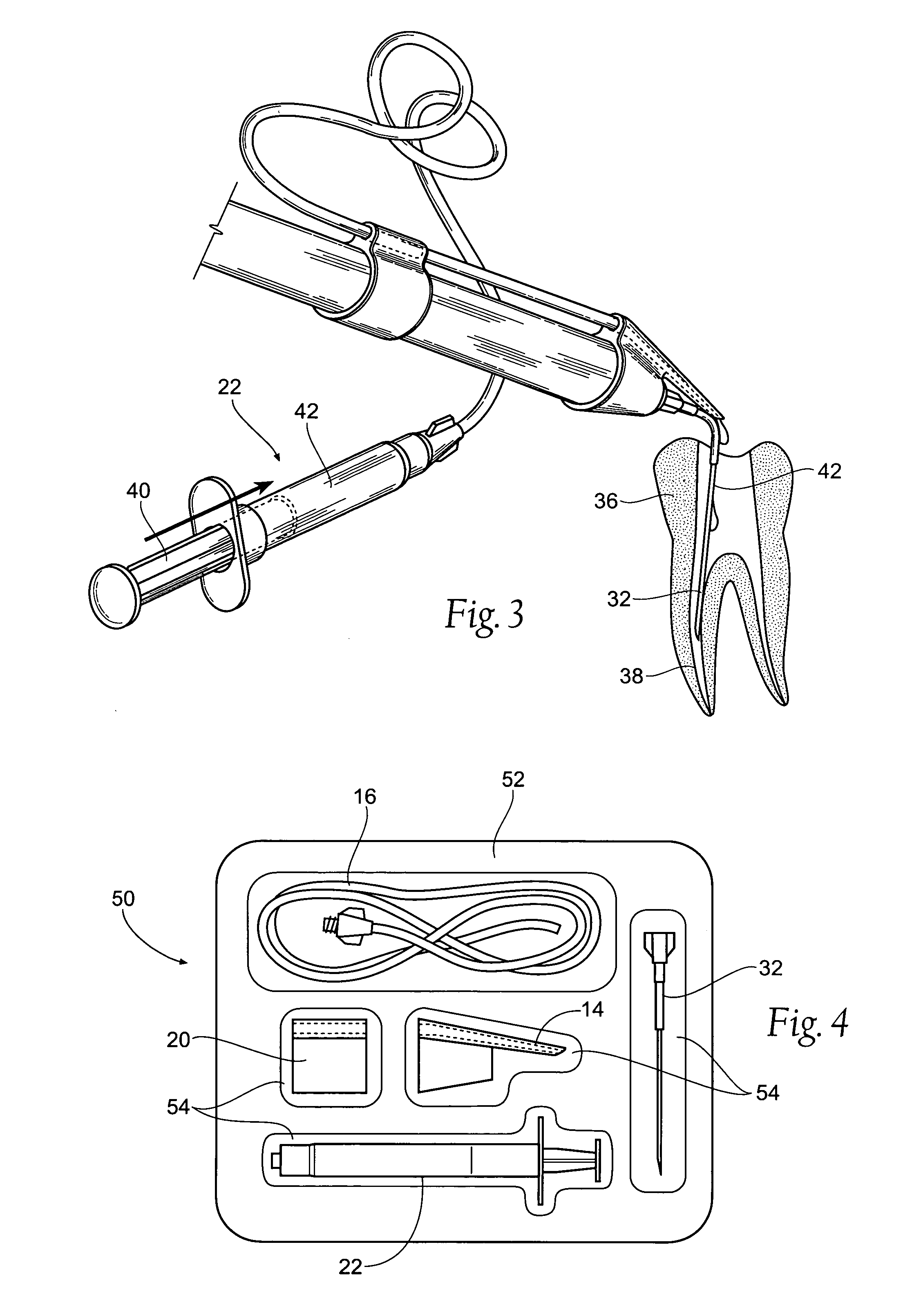 Fluid bypass device for handheld dental devices