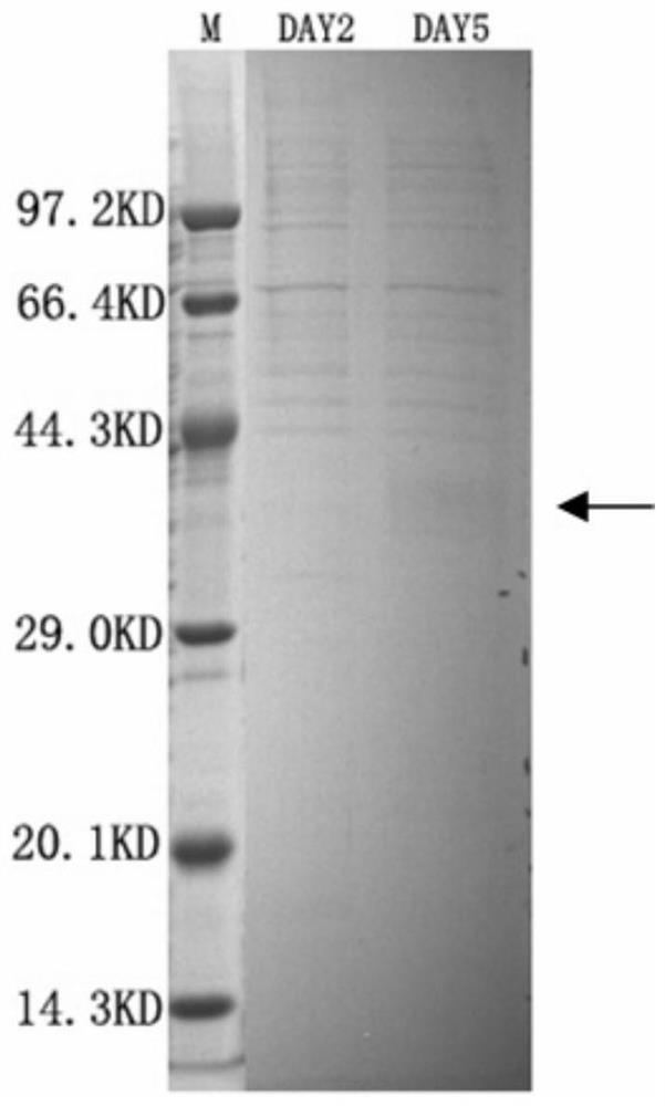 Kit for detecting endoplasmic reticulum membrane protein complex subunit 10 in human serum