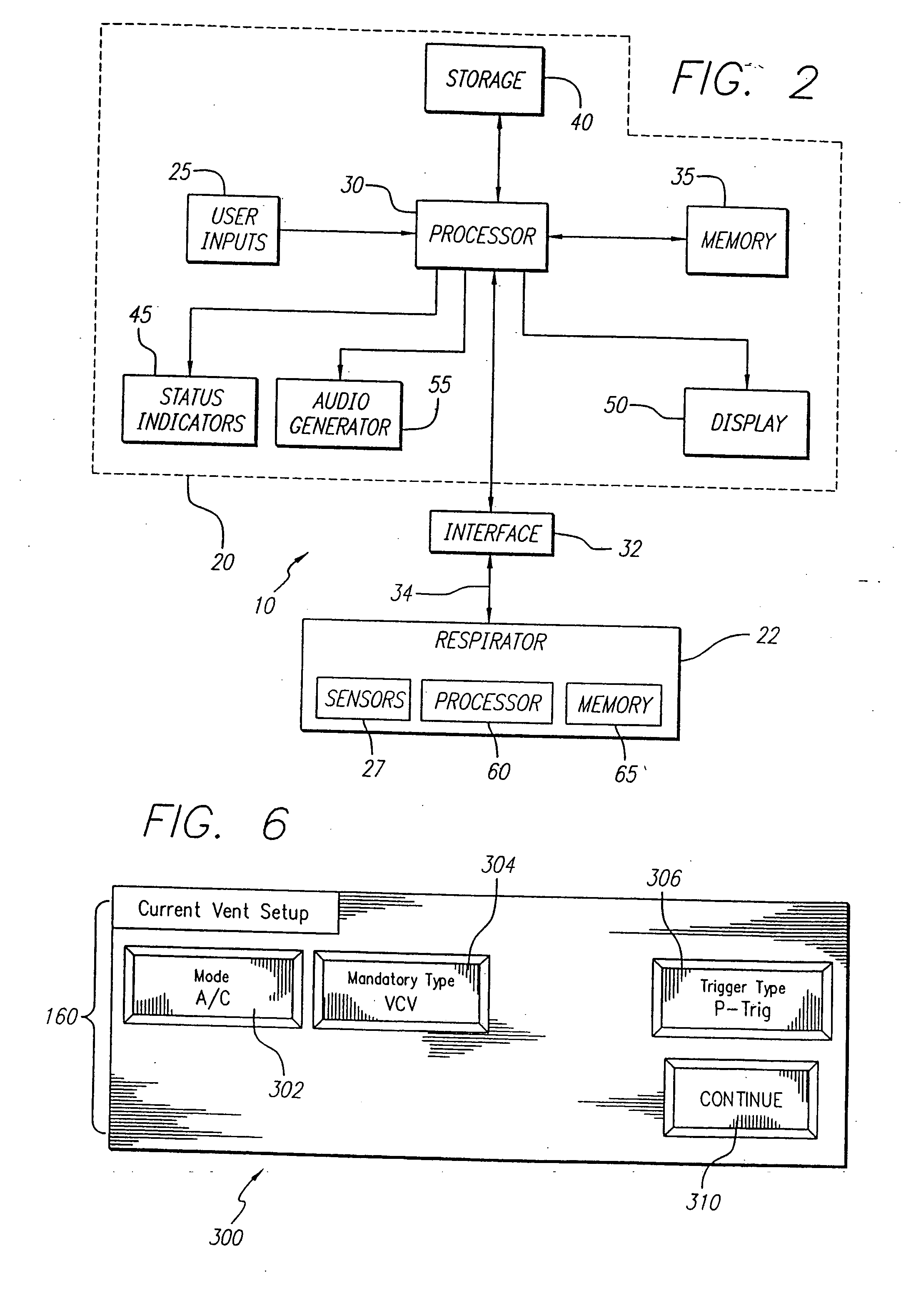 Ventilator breath display and graphic user interface