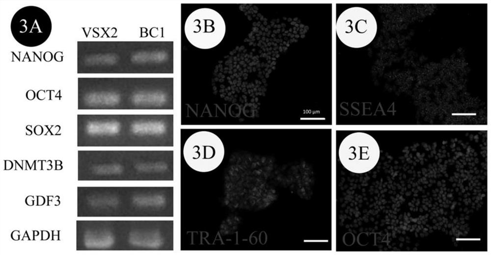 VSX2 green fluorescence reporter gene vector system and construction method thereof