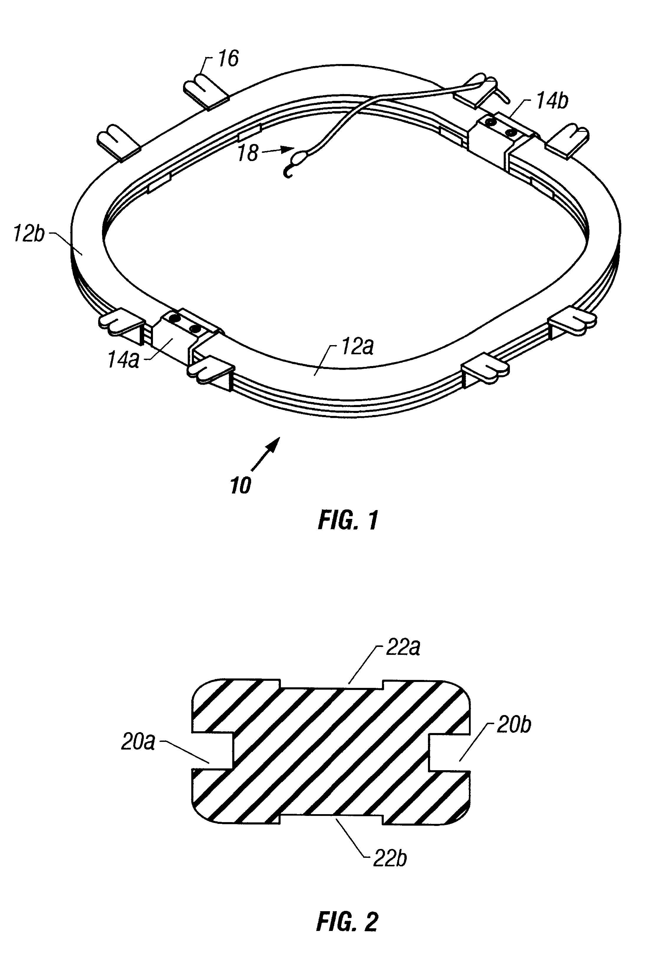 Variable geometry retractor and disposable retractor stay clips and method of use