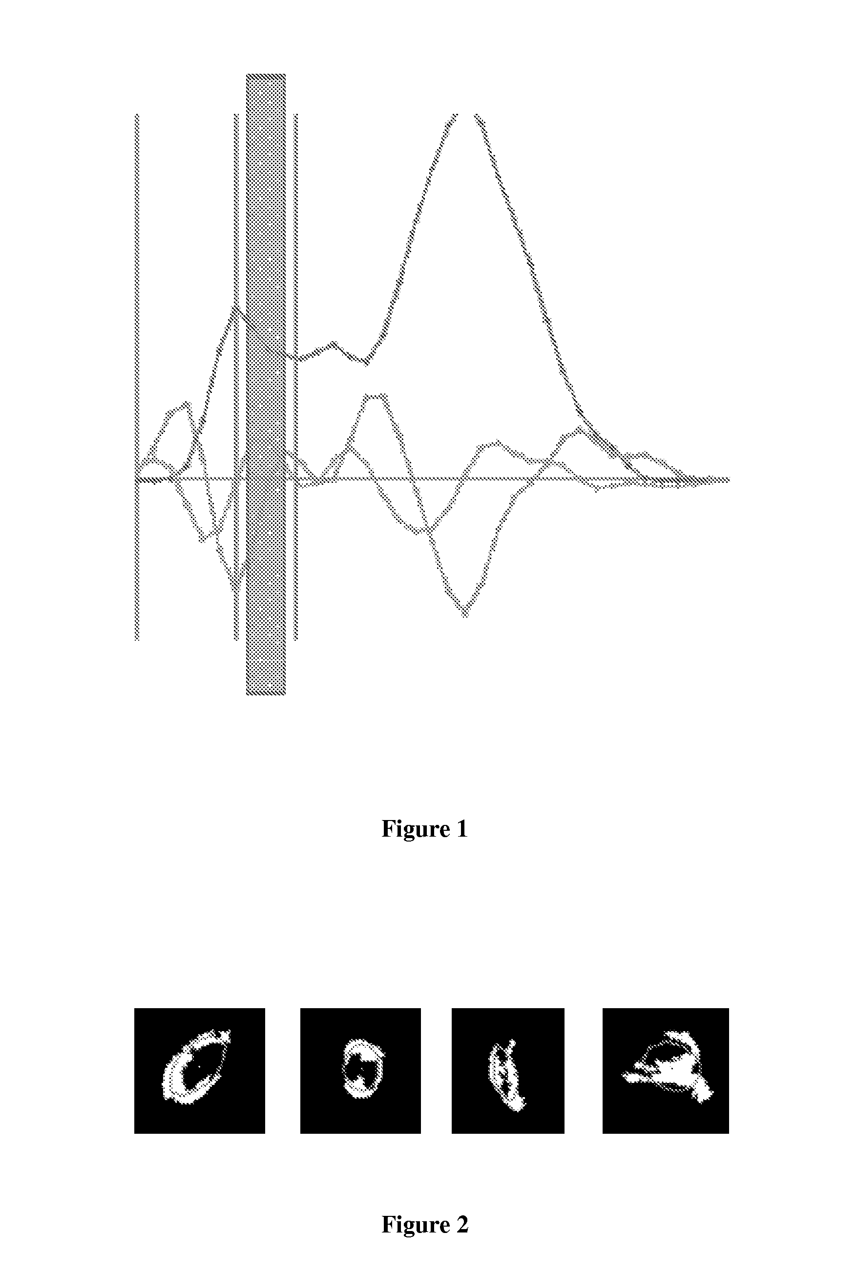 Method for identifying colon polyps in a computed tomography colonography dataset