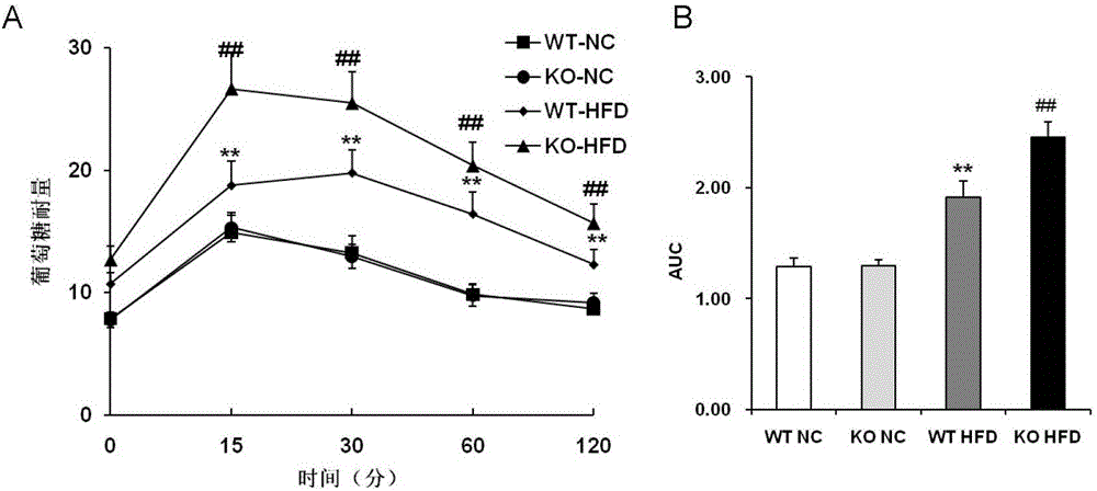 Function and use of bispecific phosphatase 14 in treatment on nonalcoholic fatty liver and type 2 diabetes