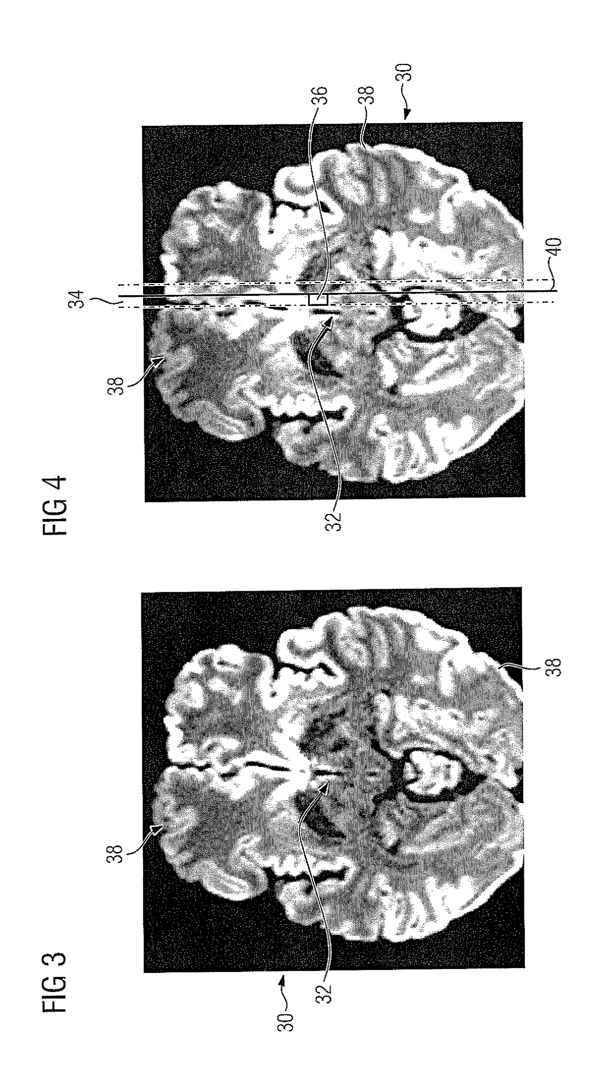 Method and imaging apparatus for optimizing a signal-to-noise ratio of a magnetic resonance image