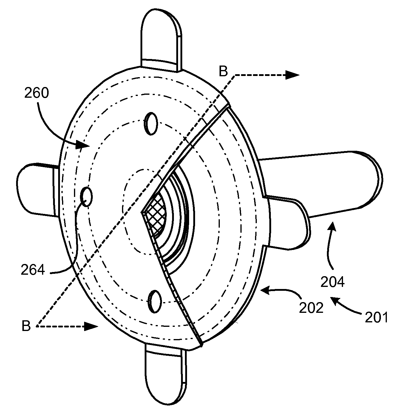 Pneumostoma management system having a cosmetic and/or protective cover