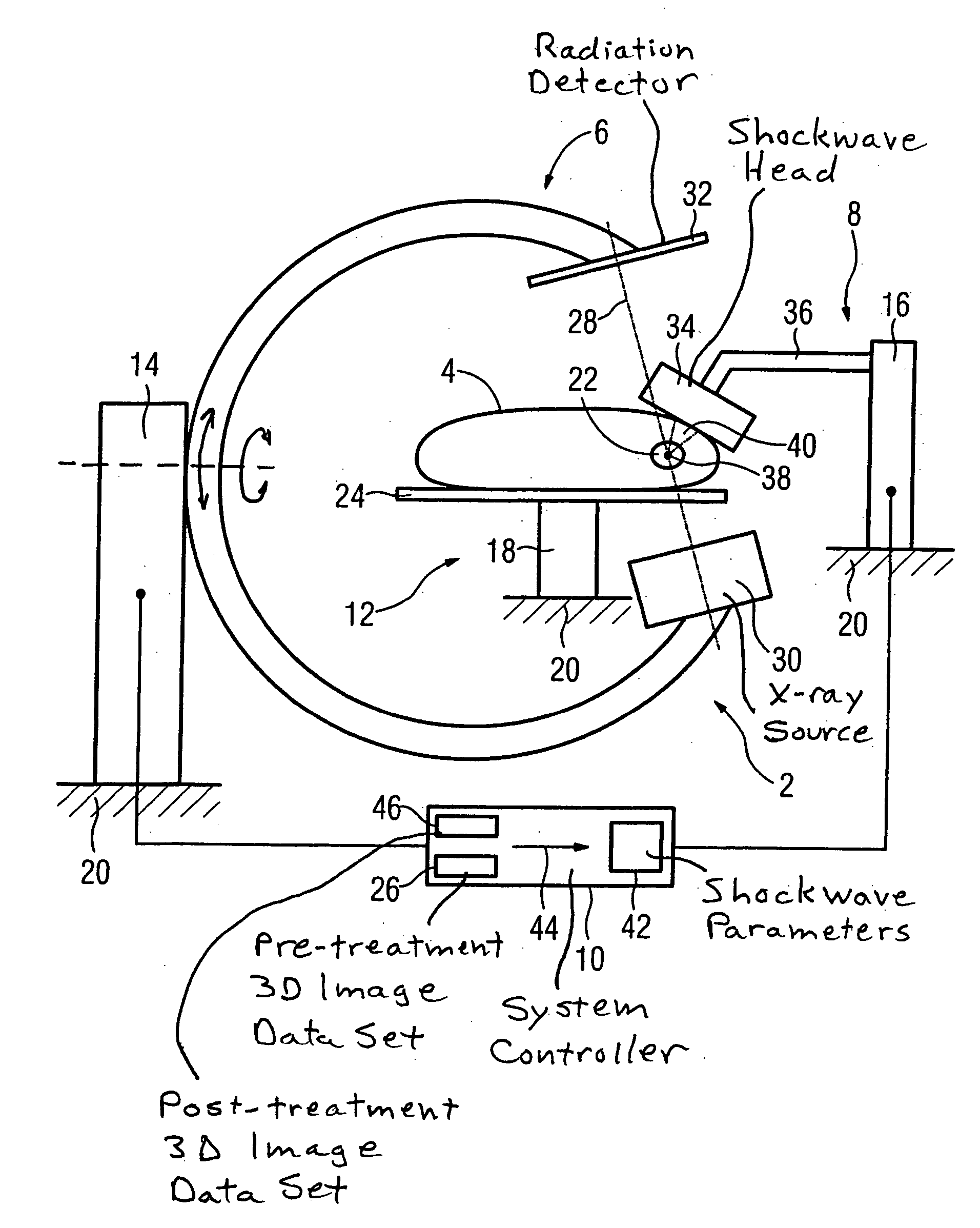 Lithotripsy method and system without patient relocation between diagnostic imaging and treatment