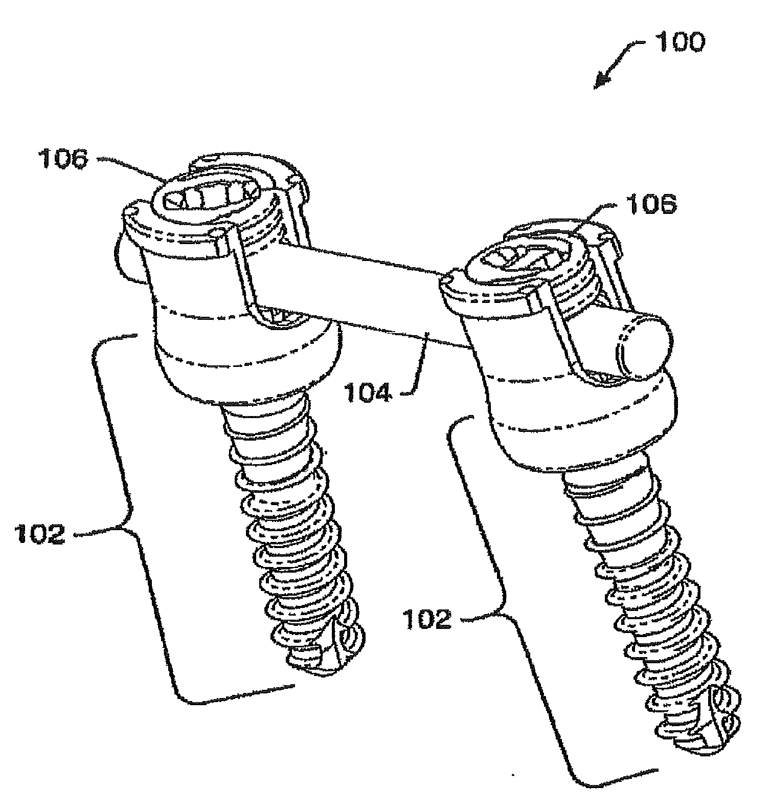 Mis crosslink apparatus and methods for spinal implant