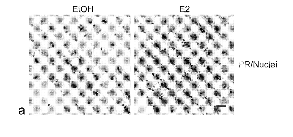 Isolation and long-term culturing of estrogen receptor-positive human breast epithelial cells