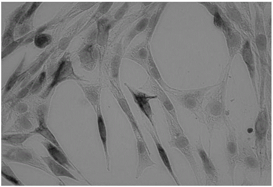Skeletal muscle stem cell serum-free medium and preparation method and application thereof