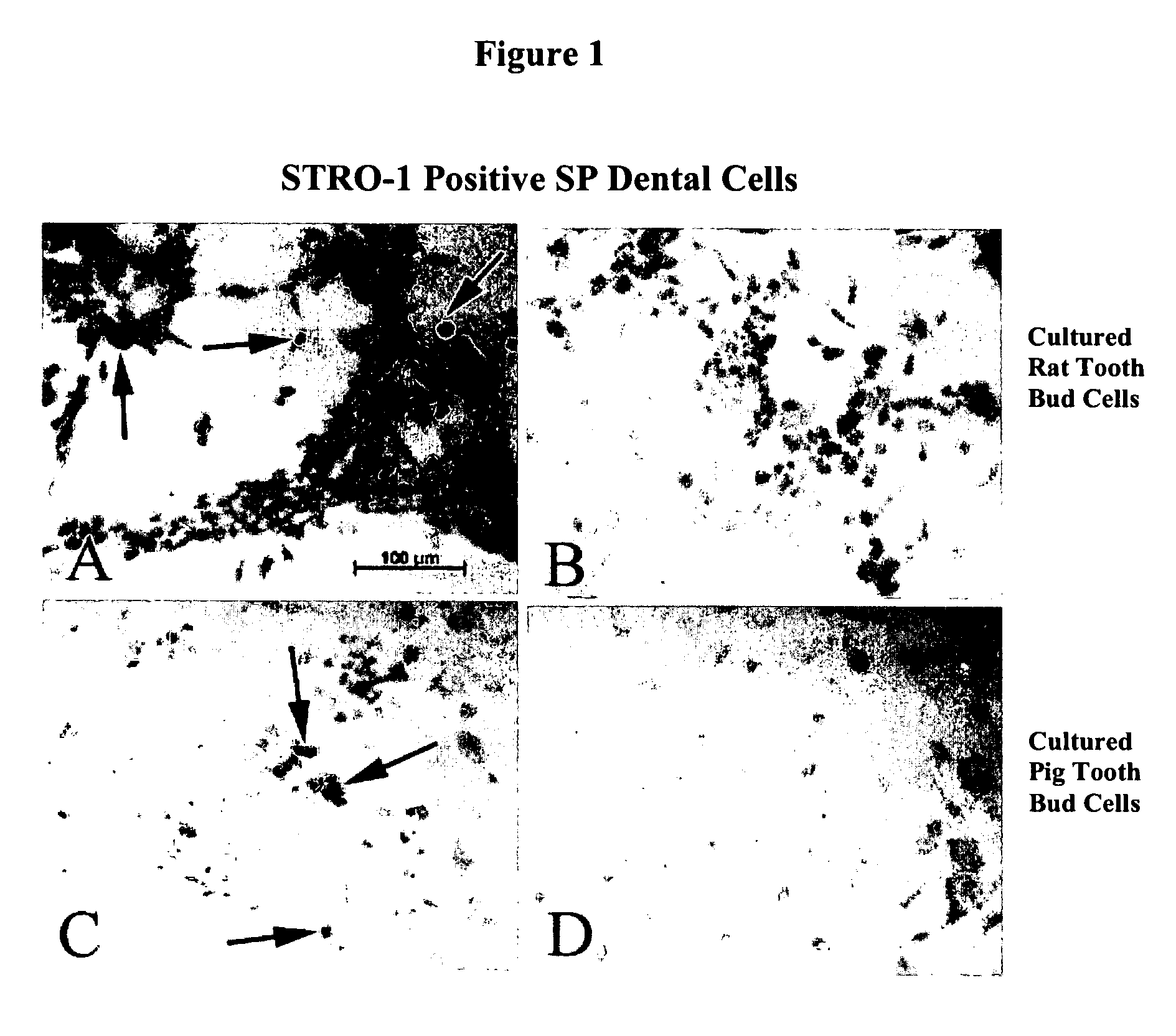 Methods and compositions for bioengineering a tooth