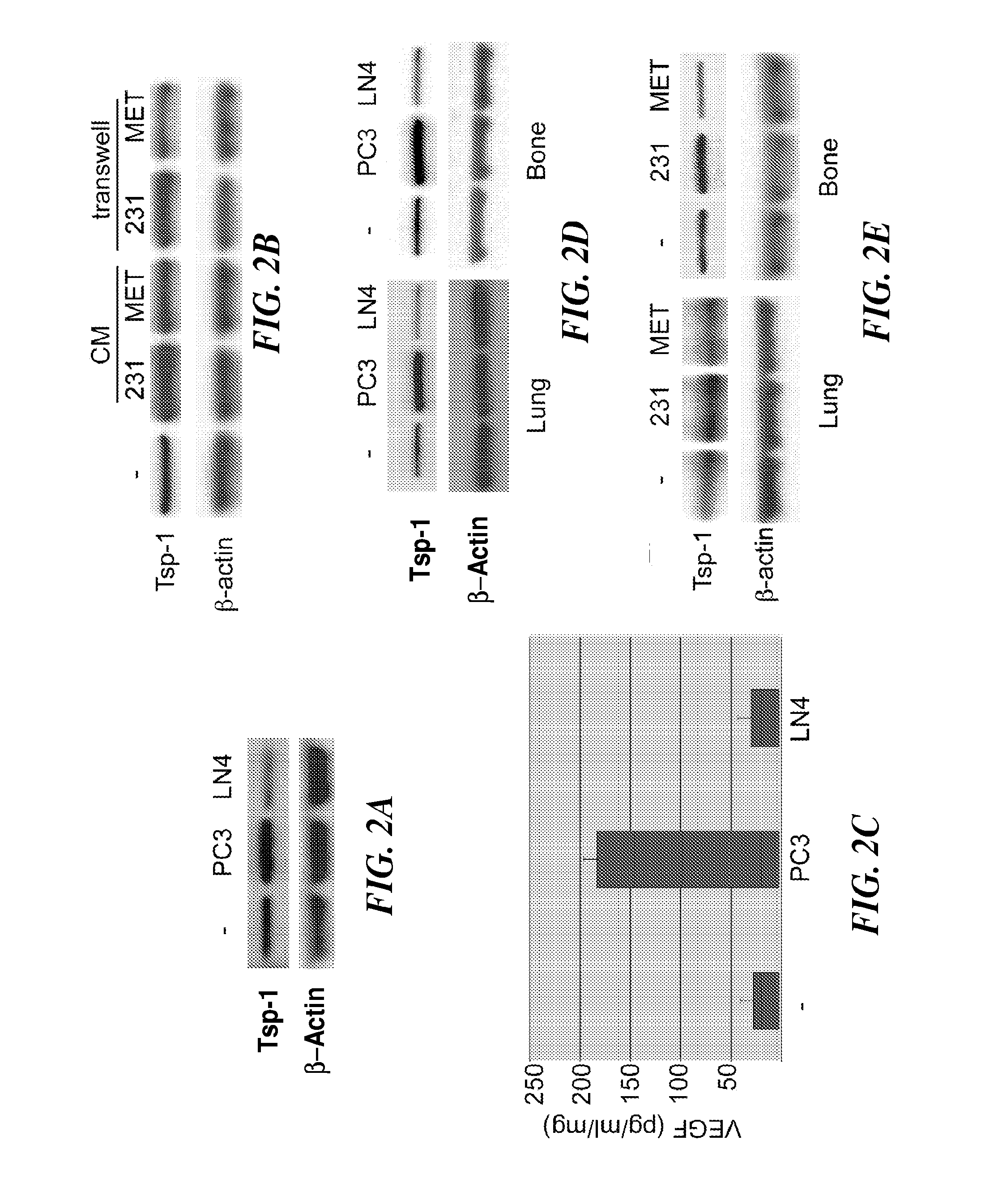 Saposin-a derived peptides and uses thereof