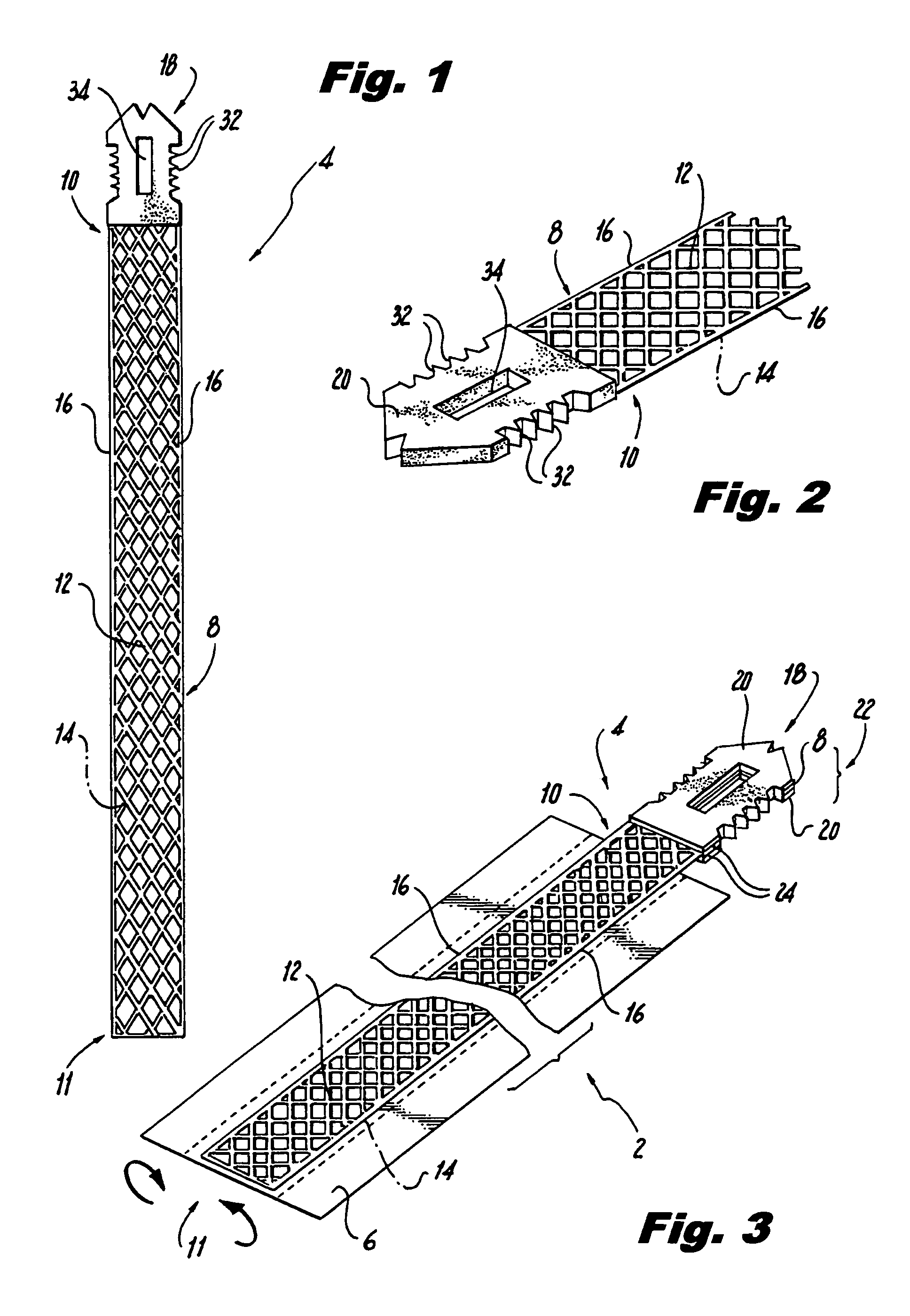 Method of facial reconstructive surgery using a self-anchoring tissue lifting device