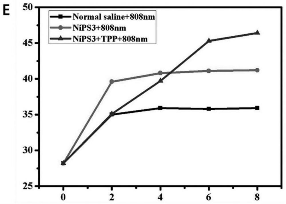 NiPS3 nano-drug with tumor targeting, preparation method thereof and application of NiPS3 nano-drug