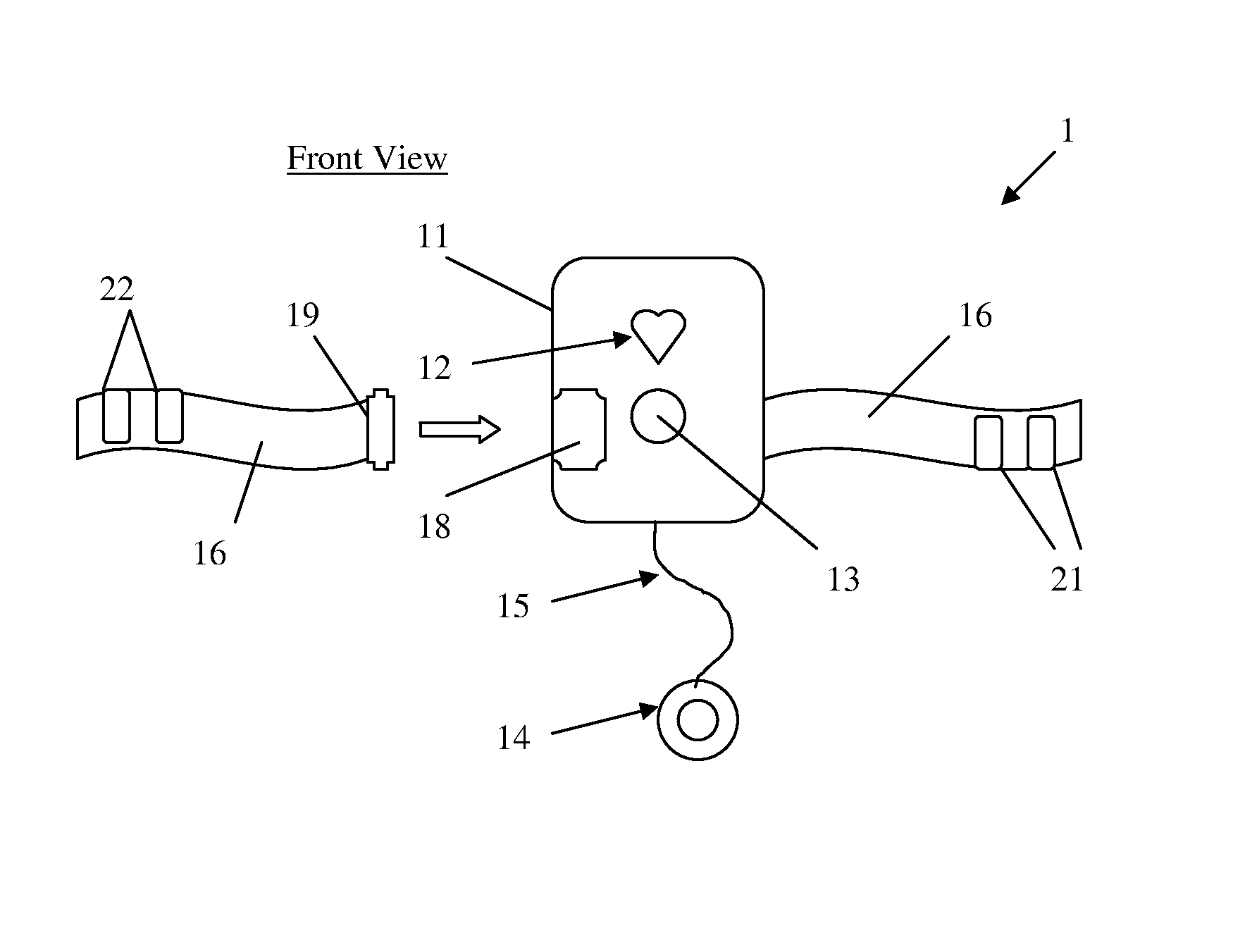 Electrocardiographic monitoring system and method