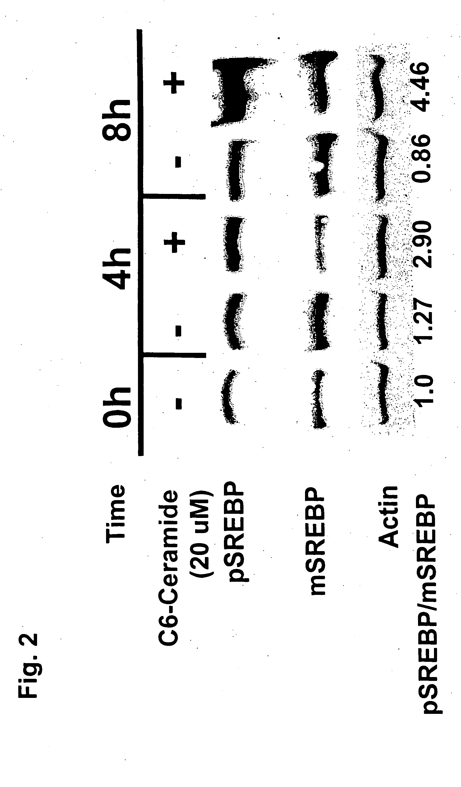 Ceramide de novo synthesis-based therapeutic and prophylactic methods, and related articles of manufacture