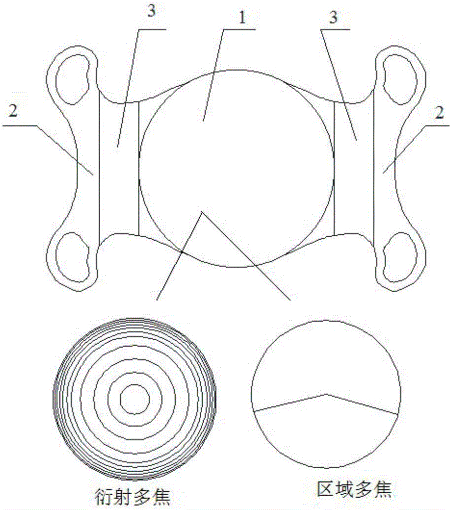 Variable multi-focus artificial lens