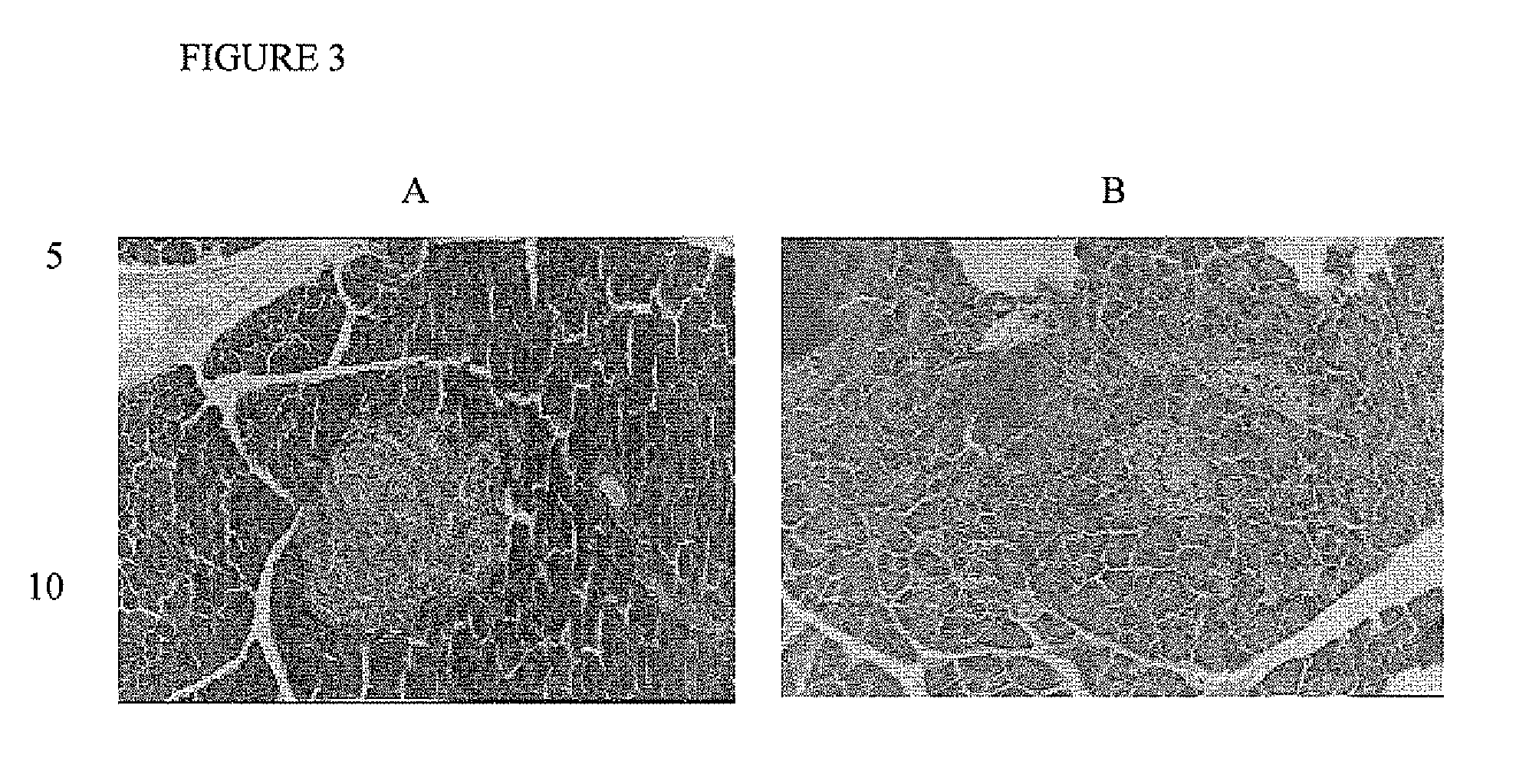 Method of treating and/or preventing type II diabetes using Actinomycetales