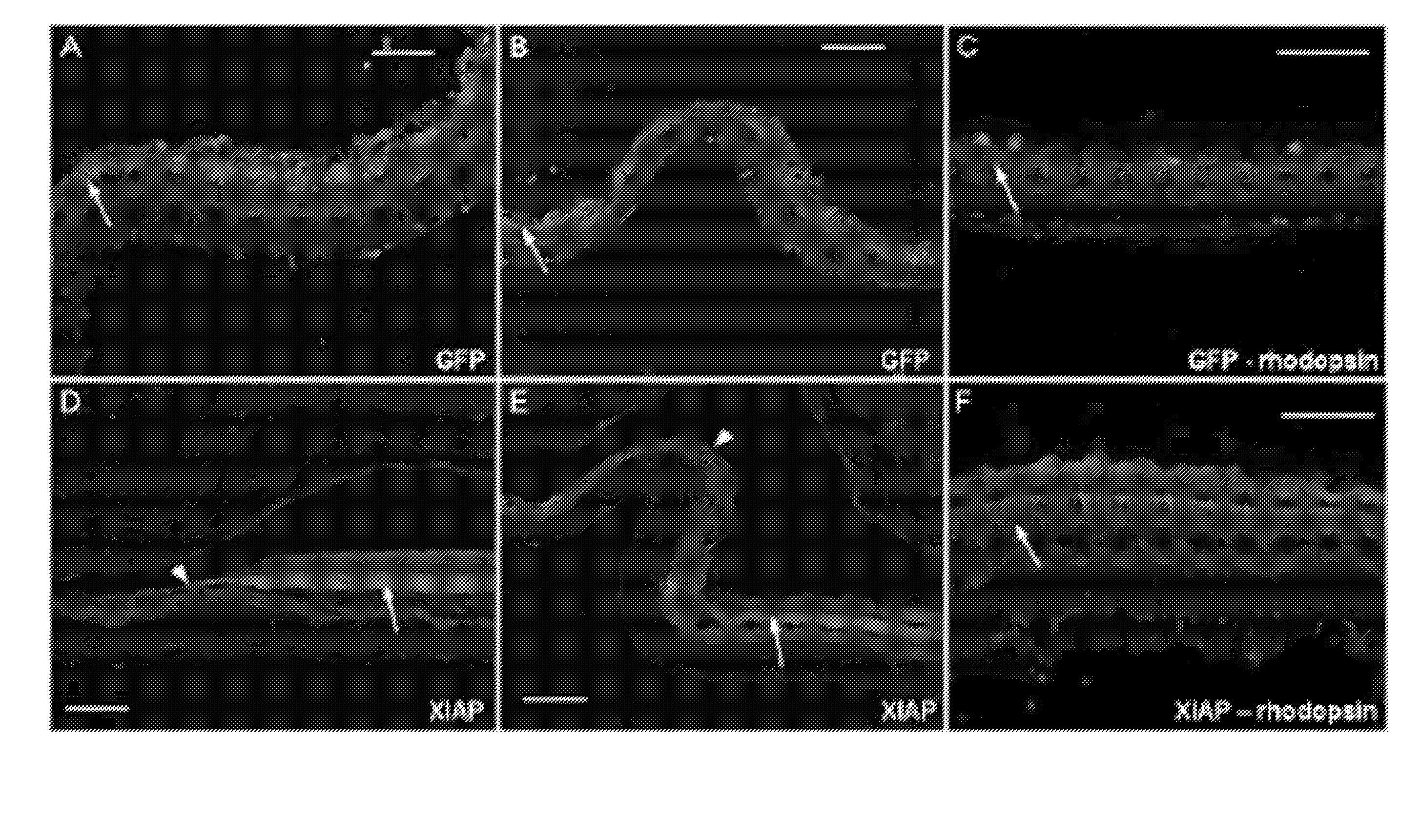 Methods of inhibiting photoreceptor apoptosis